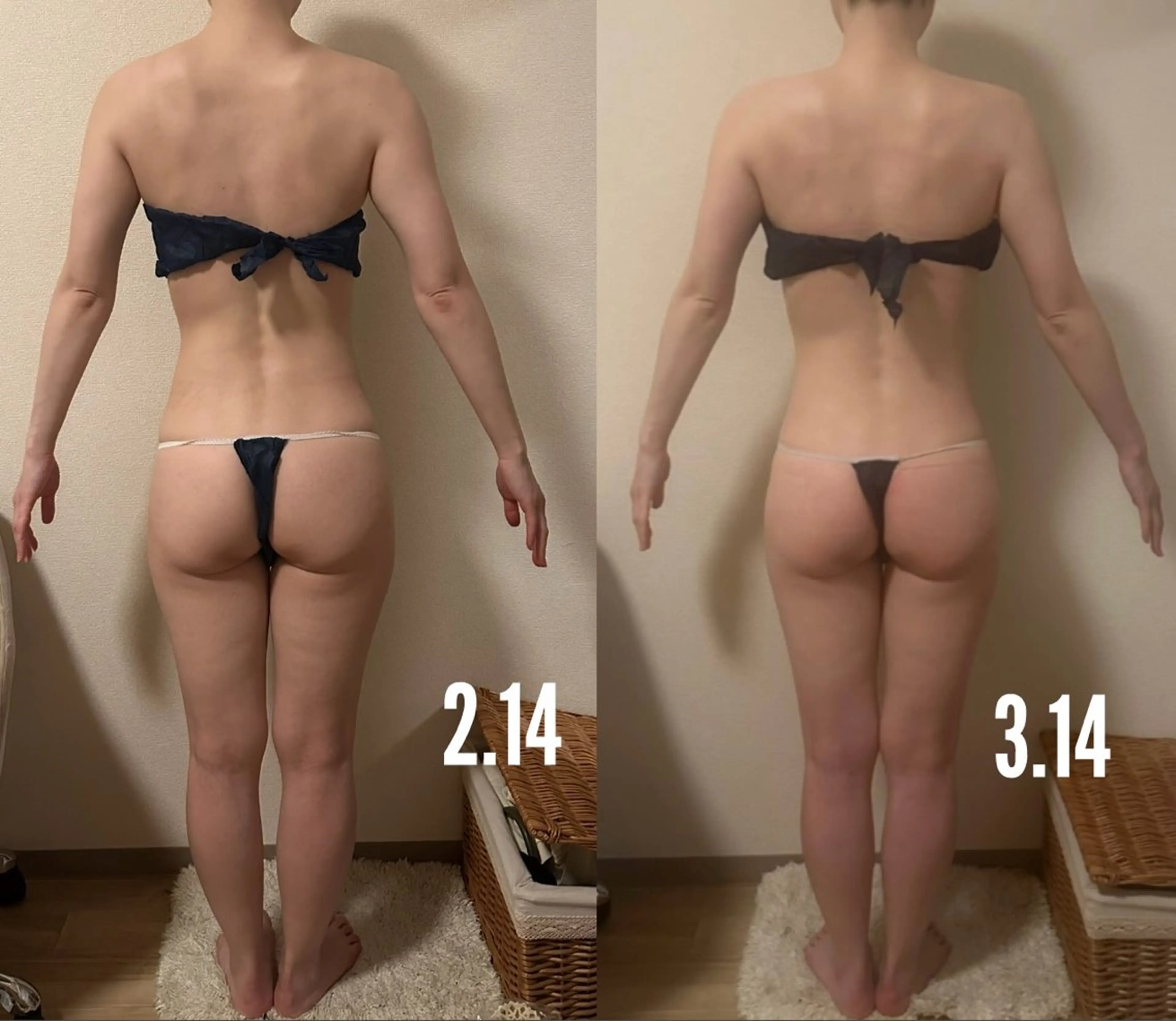 🆕体質改善サーモケア✨120分✨インディバ最新機種同等ハイスペック深部加熱マシーン➕吸引器➕カッピングの写真