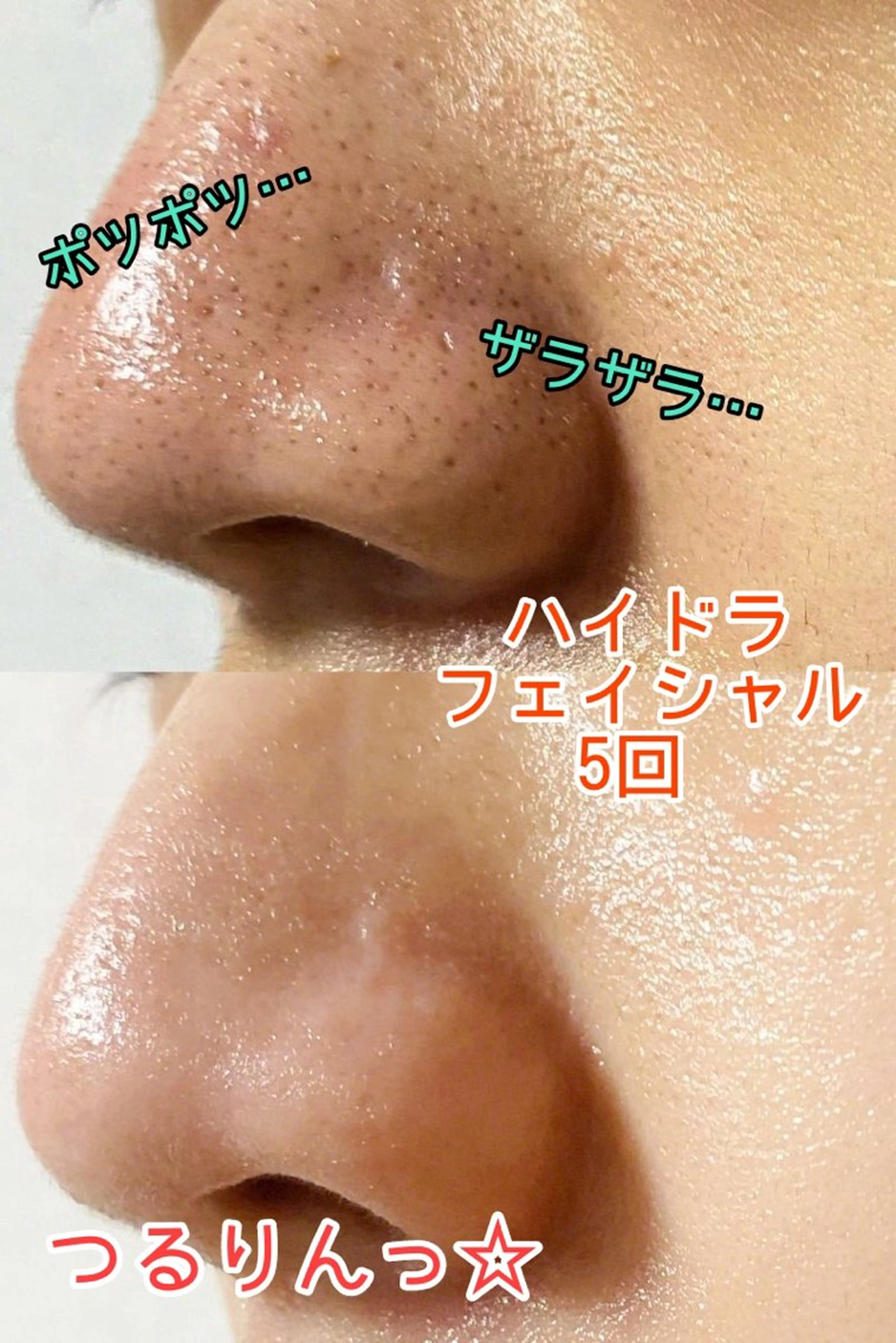 vary  clue MISAのエステ・リラクイメージ