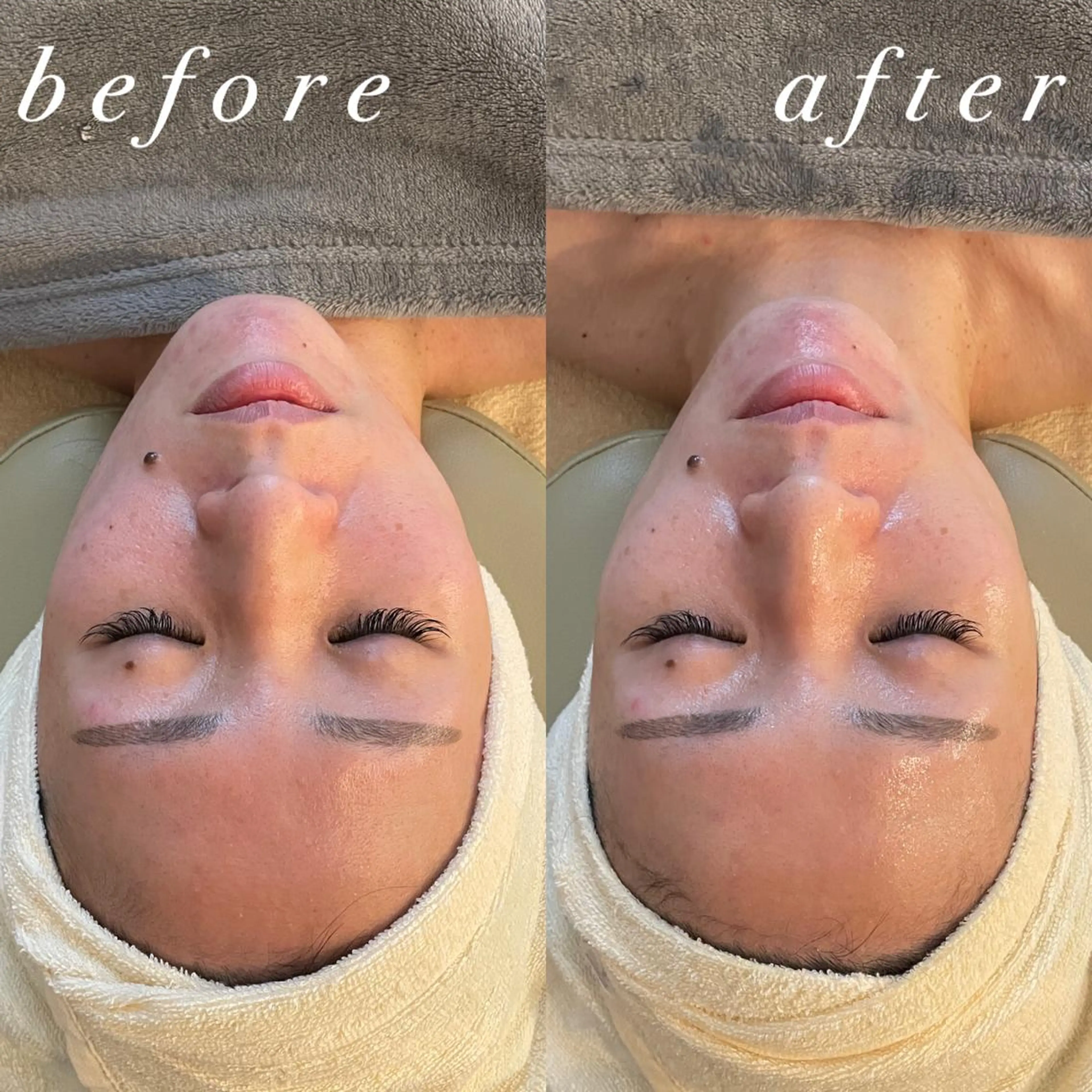 うなじ脱毛/美肌脱毛 LABELのエステ・リラクイメージ