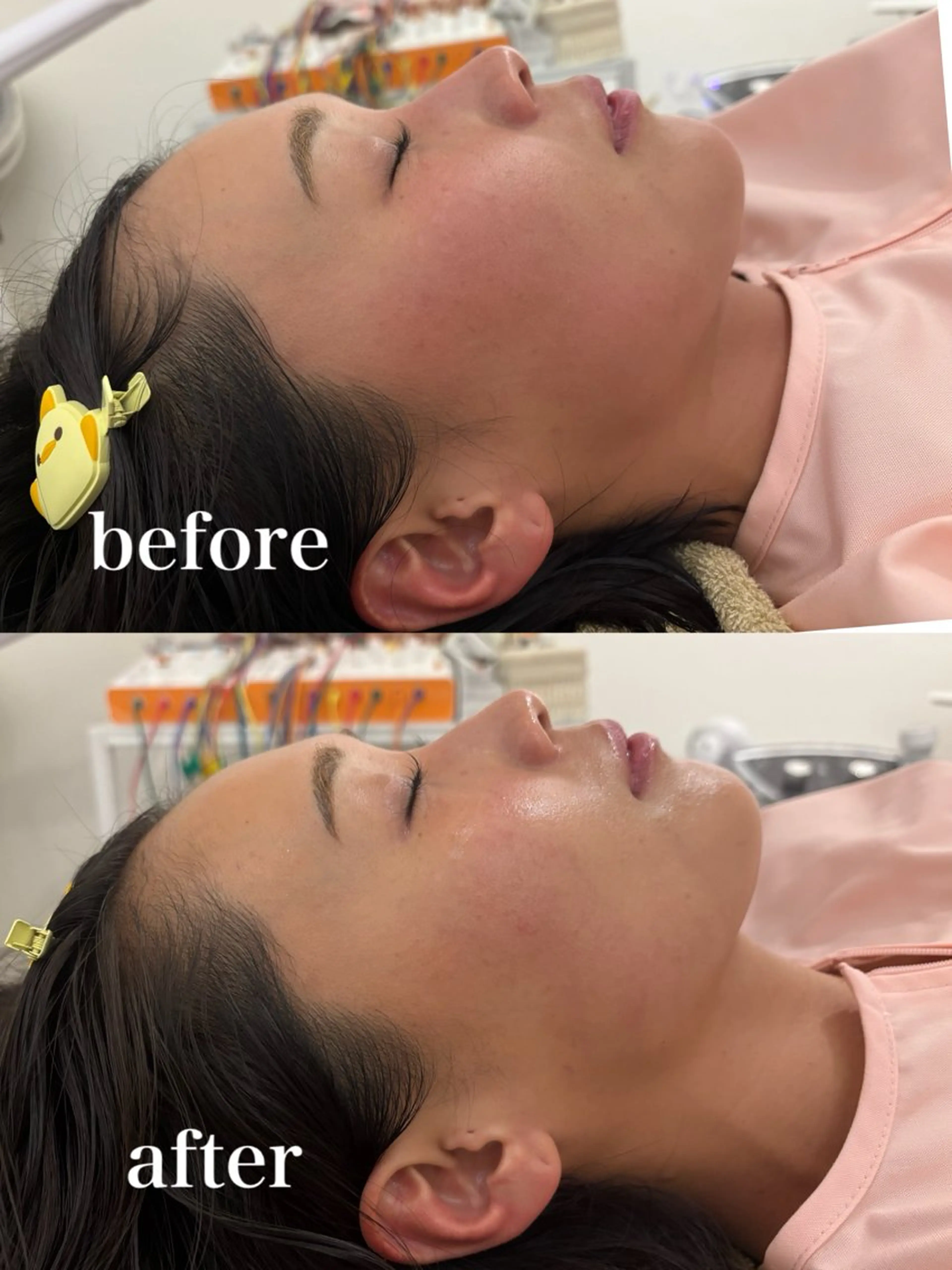 エステ リラク 美容鍼灸サロン mahoroba院長のエステ・リラクイメージ