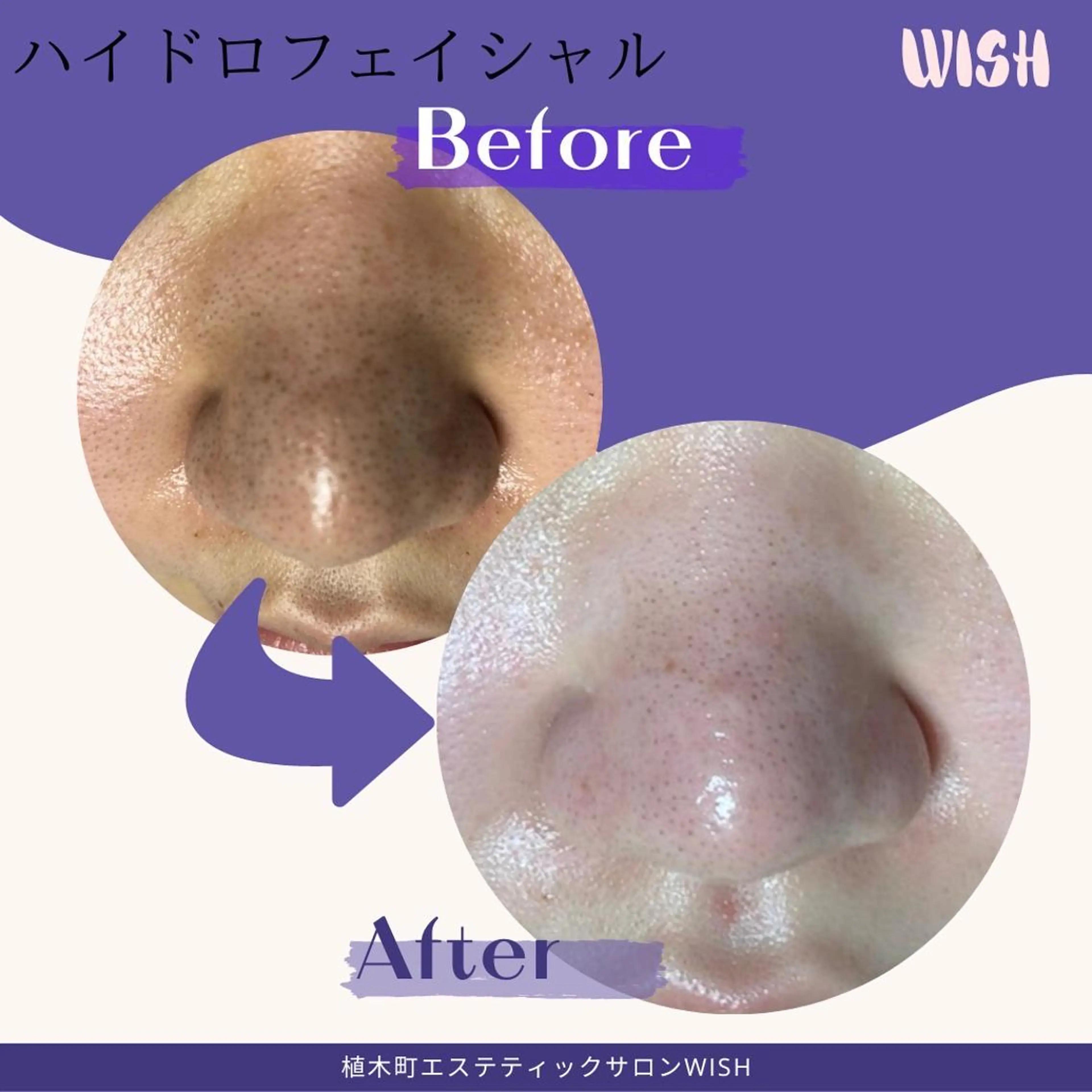 WISH 美肌脱毛のプロ！須藤のエステ・リラクイメージ