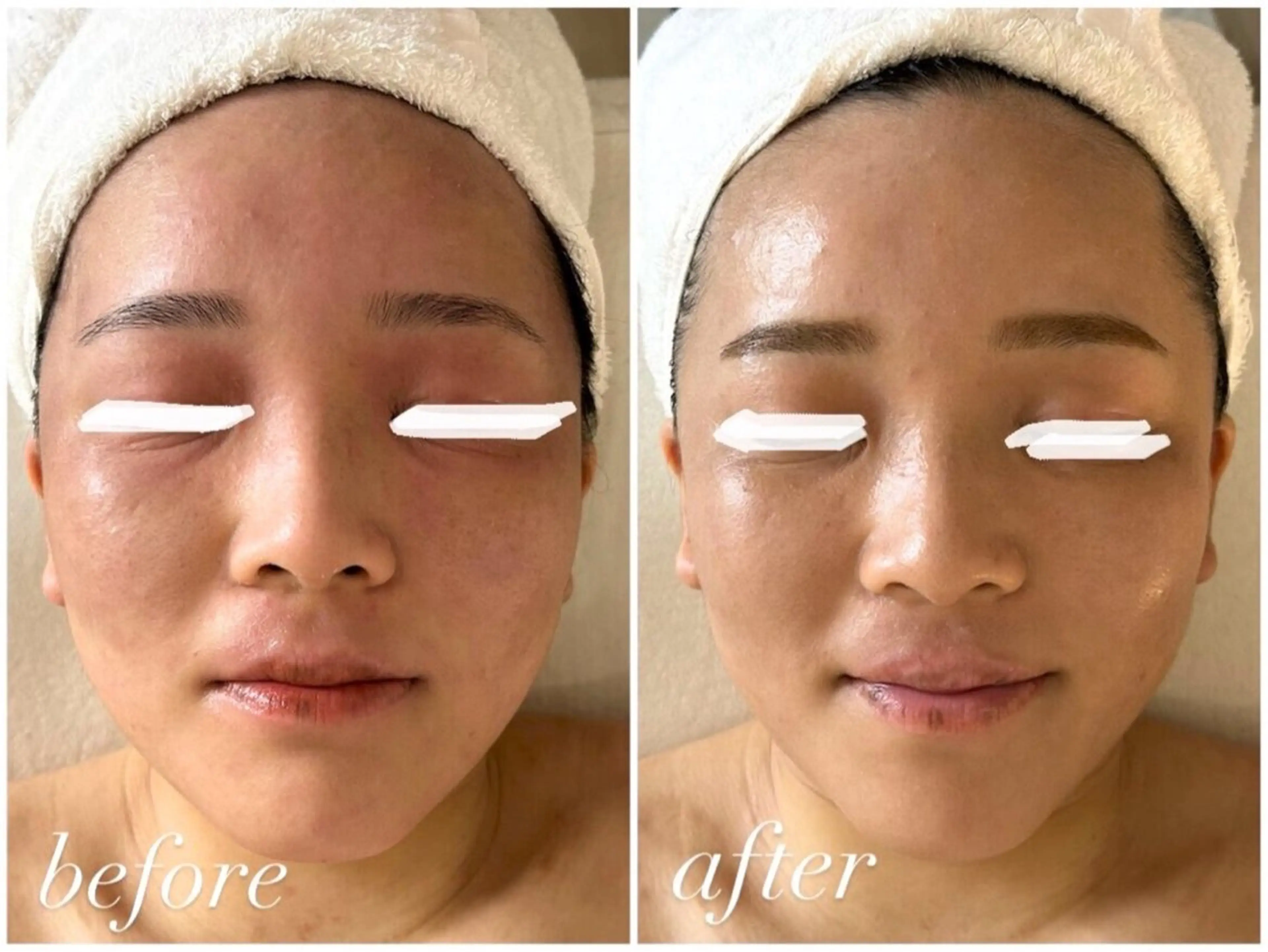 エステ リラク 田中For..天王寺 肌質改善/よもぎ蒸しのエステ・リラクイメージ