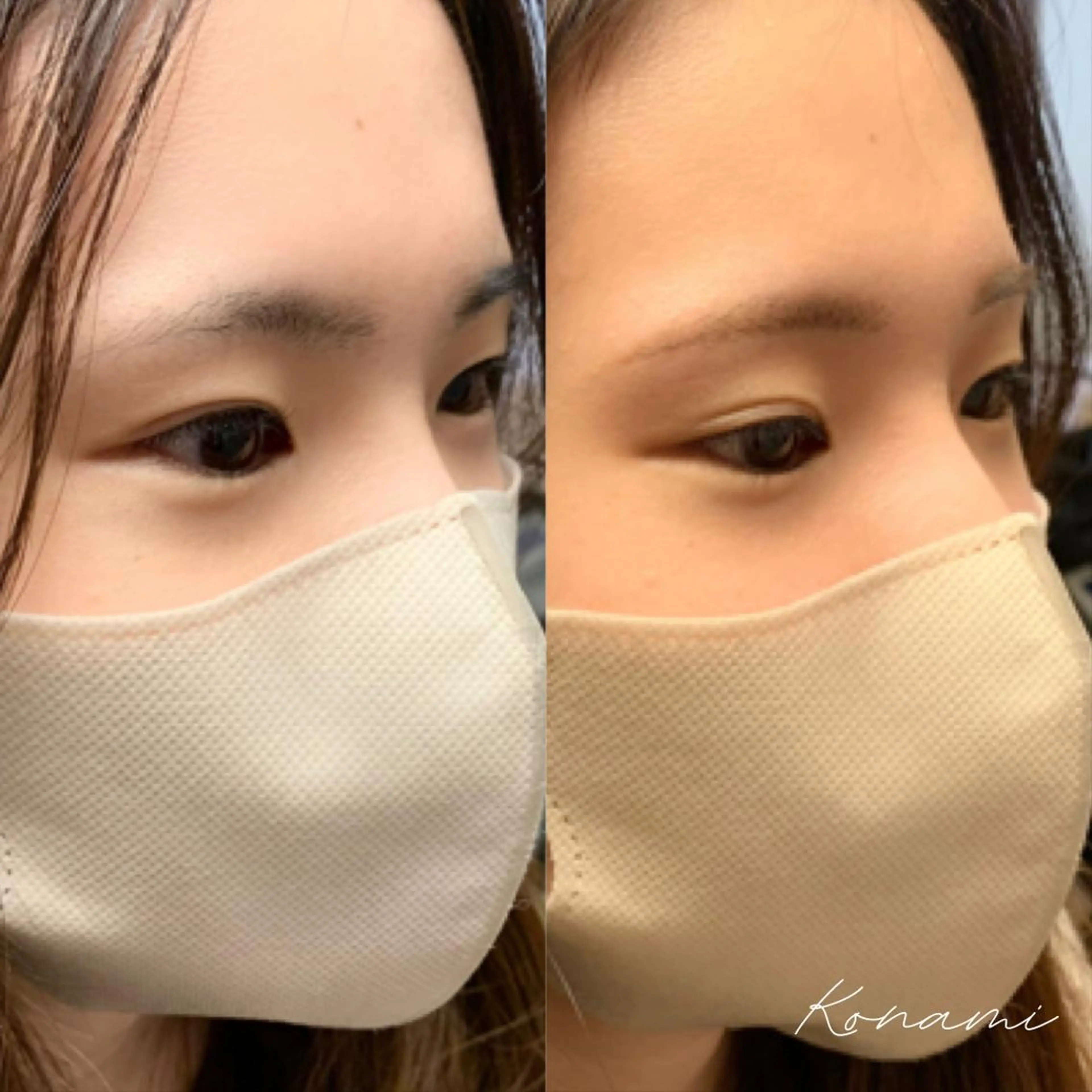 アイブロウ ワックス脱毛 シードリン 府内店 小波のエステ・リラクイメージ