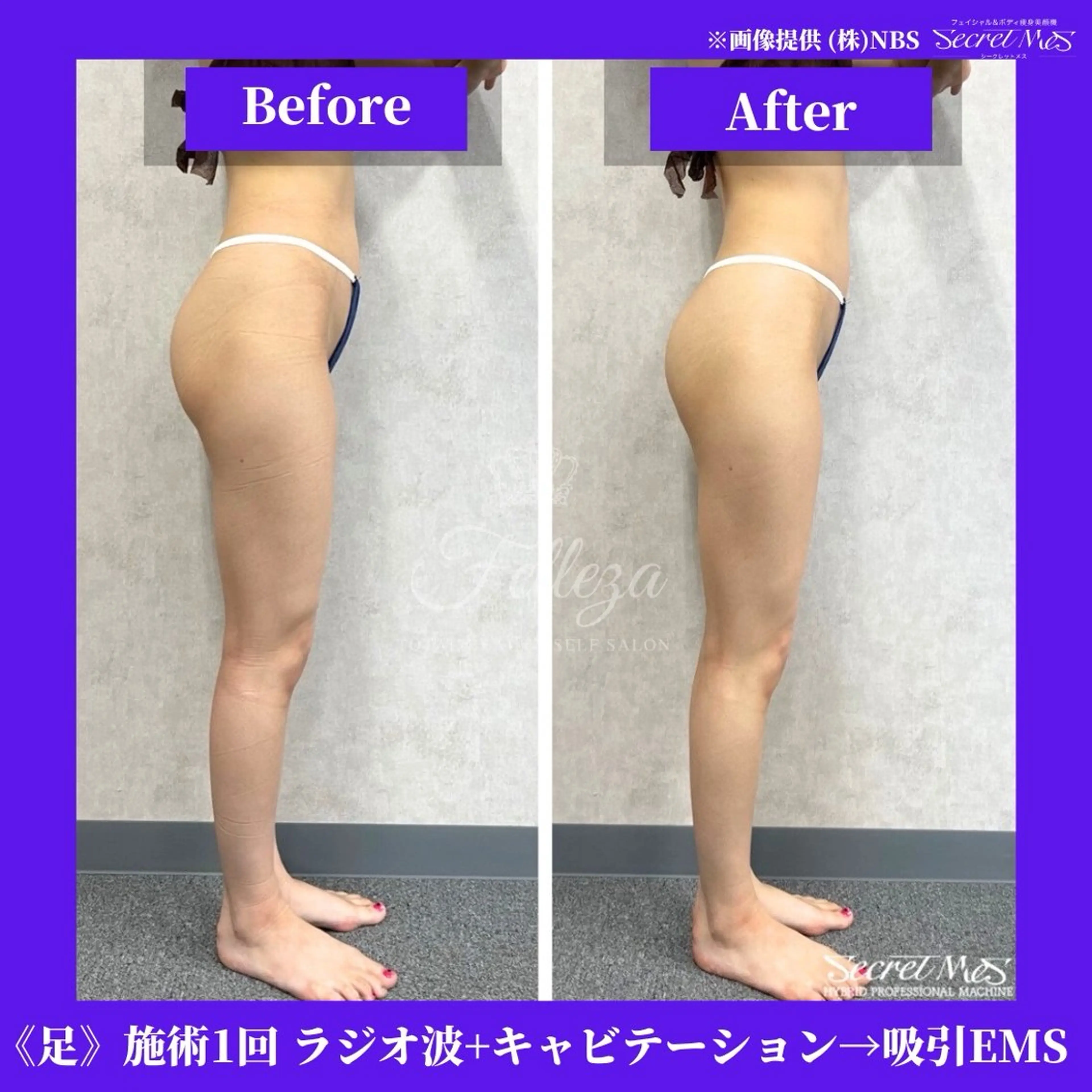 メンズ 有人型セルフサロン 脱毛／痩身／美顔のその他イメージ