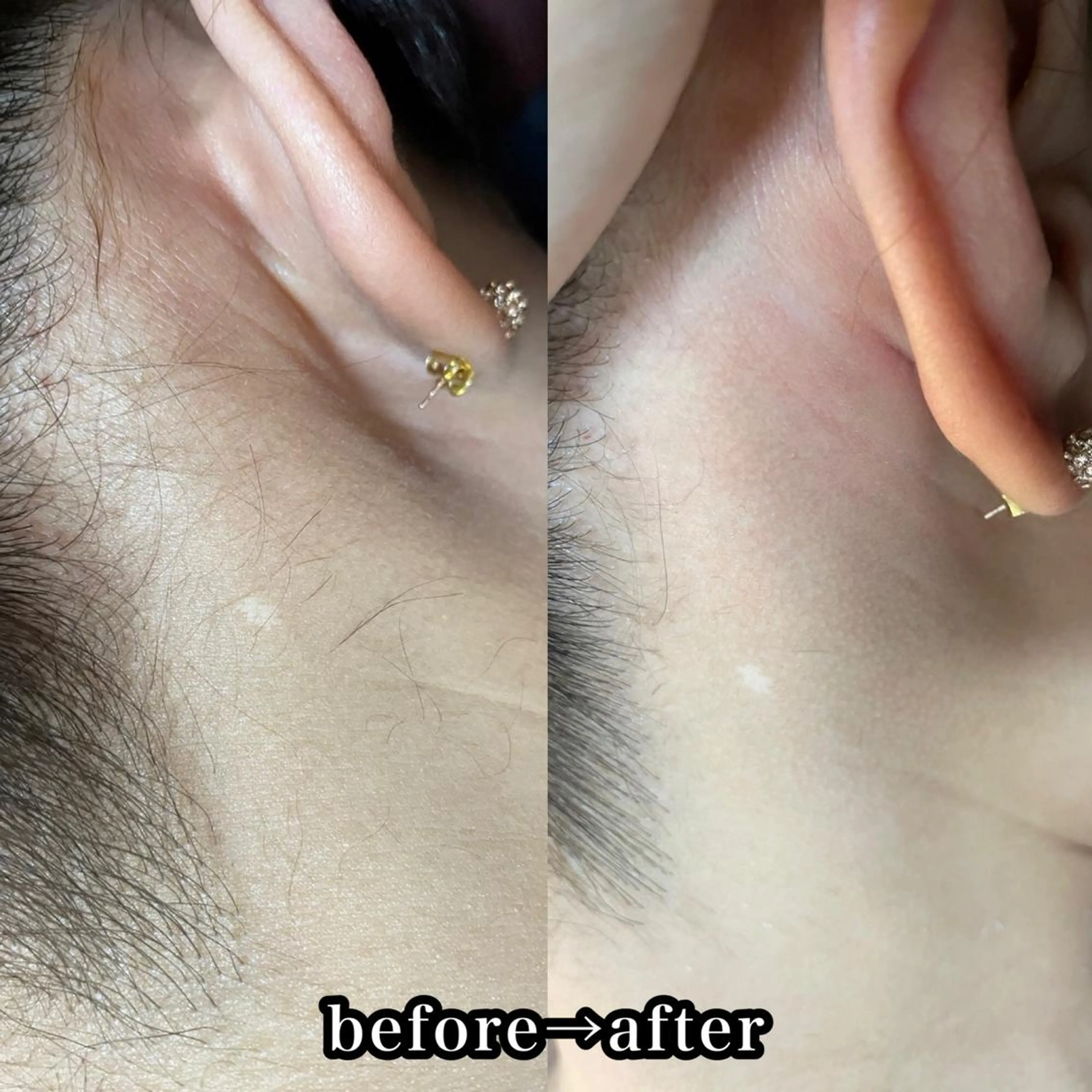 脱毛 salon improve所属・Salon Improveのネイルデザイン