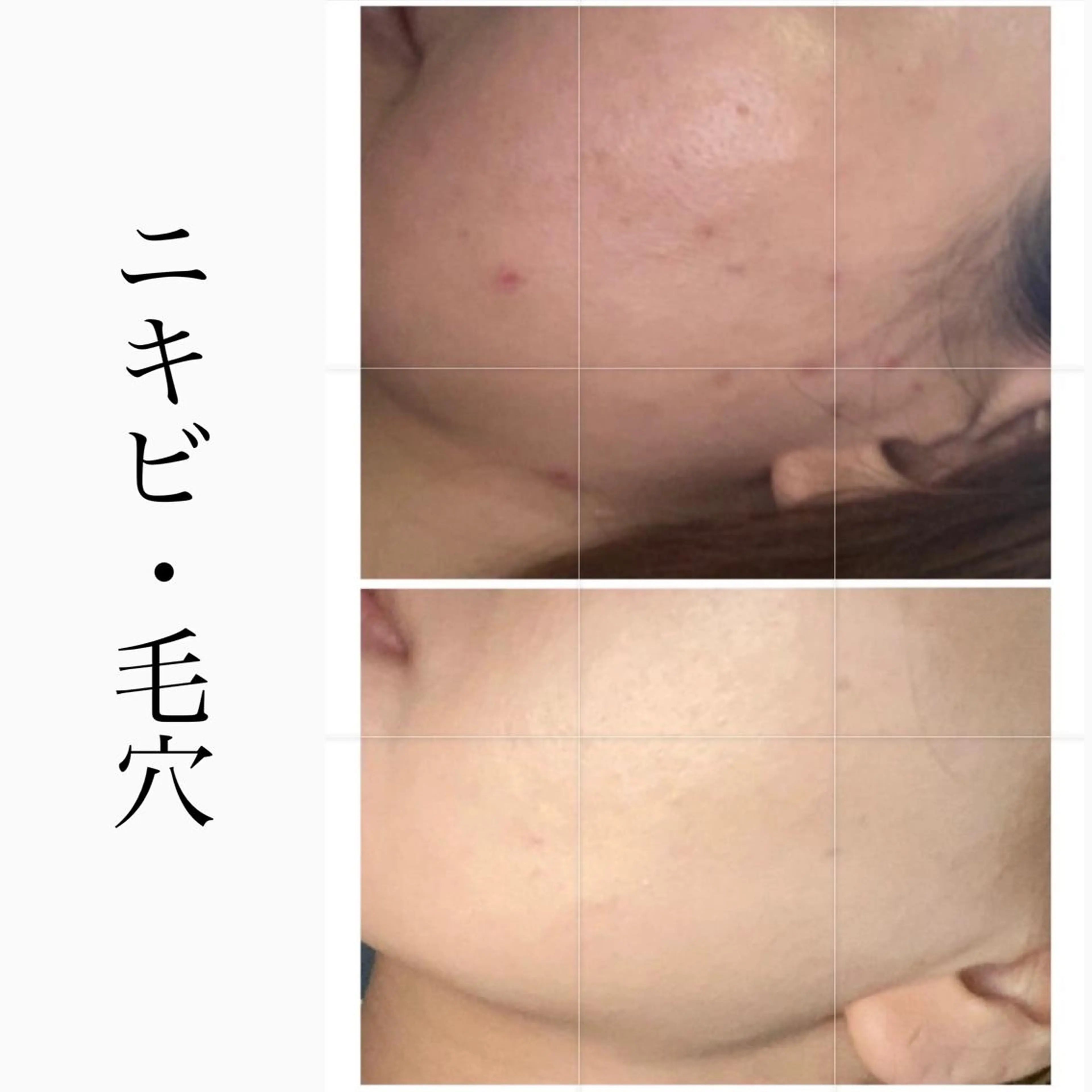 BeSkin藤沢店所属・ニキビ/肌質改善 BeSkin 藤沢店のエステ・リラクイメージ