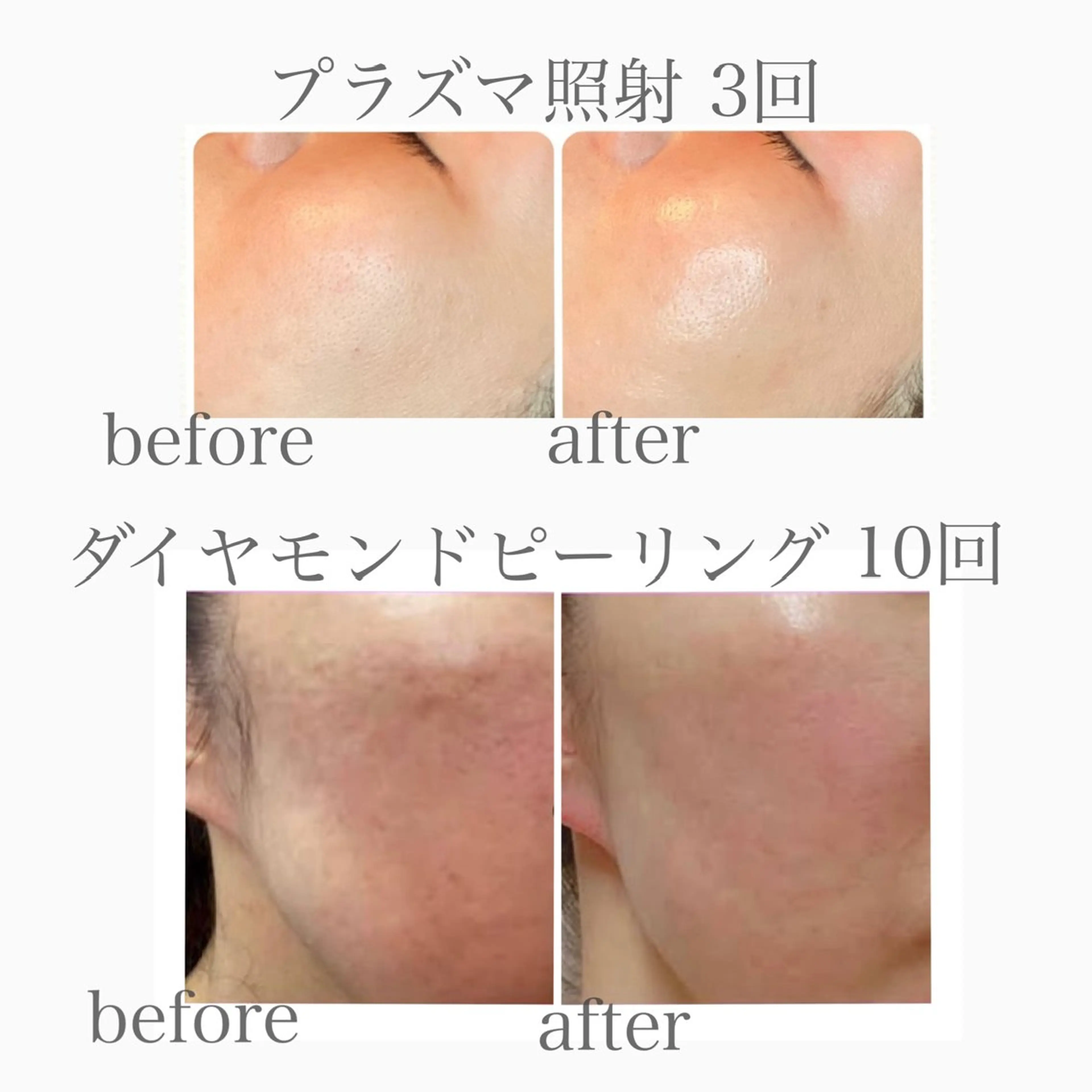 Lily branc 痩身/小顔/肌質改善のエステ・リラクイメージ