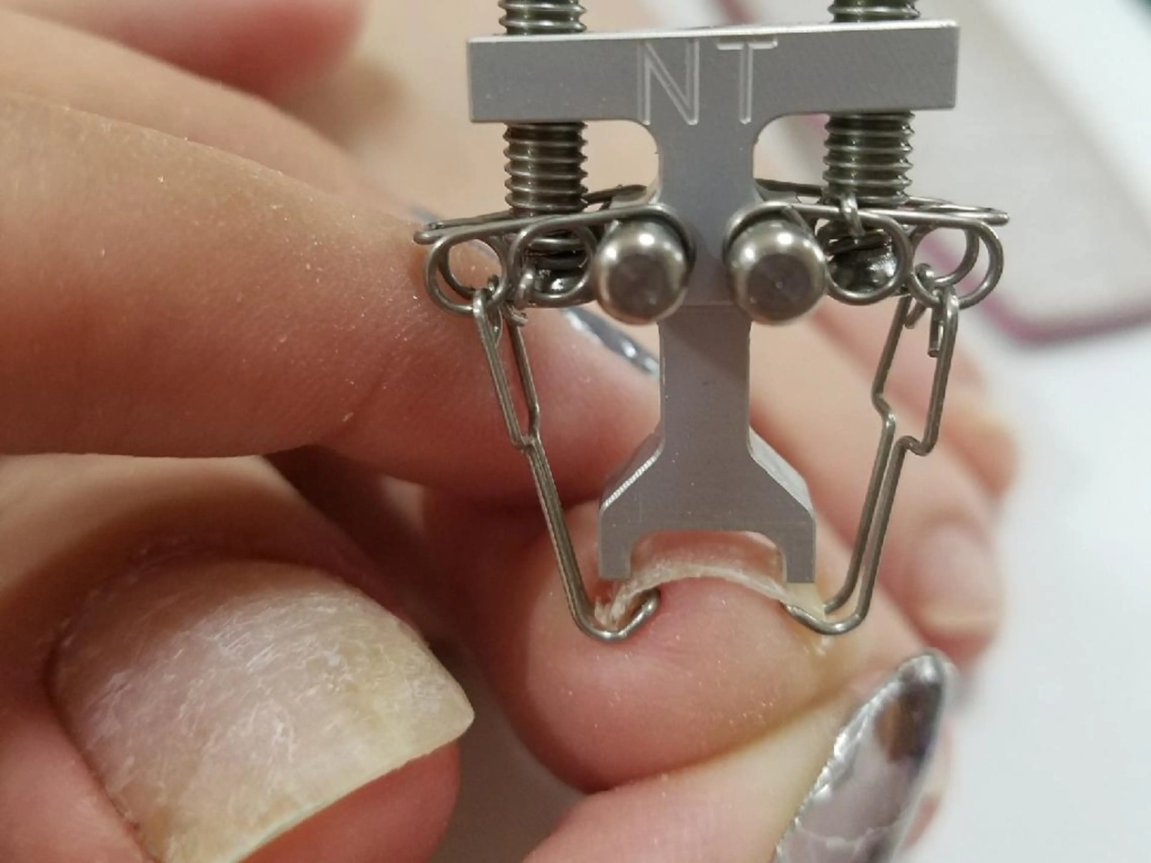 ネイル 齋藤 あゆみのネイルデザイン