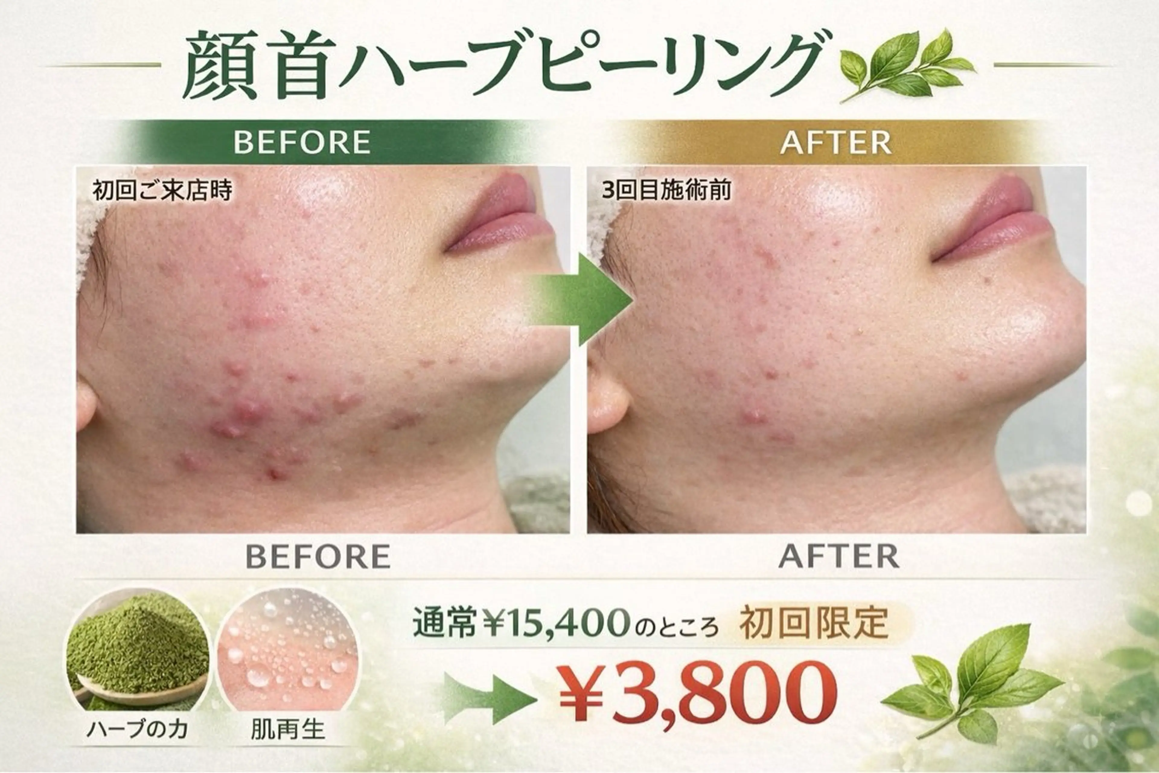 みんなの脱毛ツルリン ☀️船橋店☀️のエステ・リラクイメージ