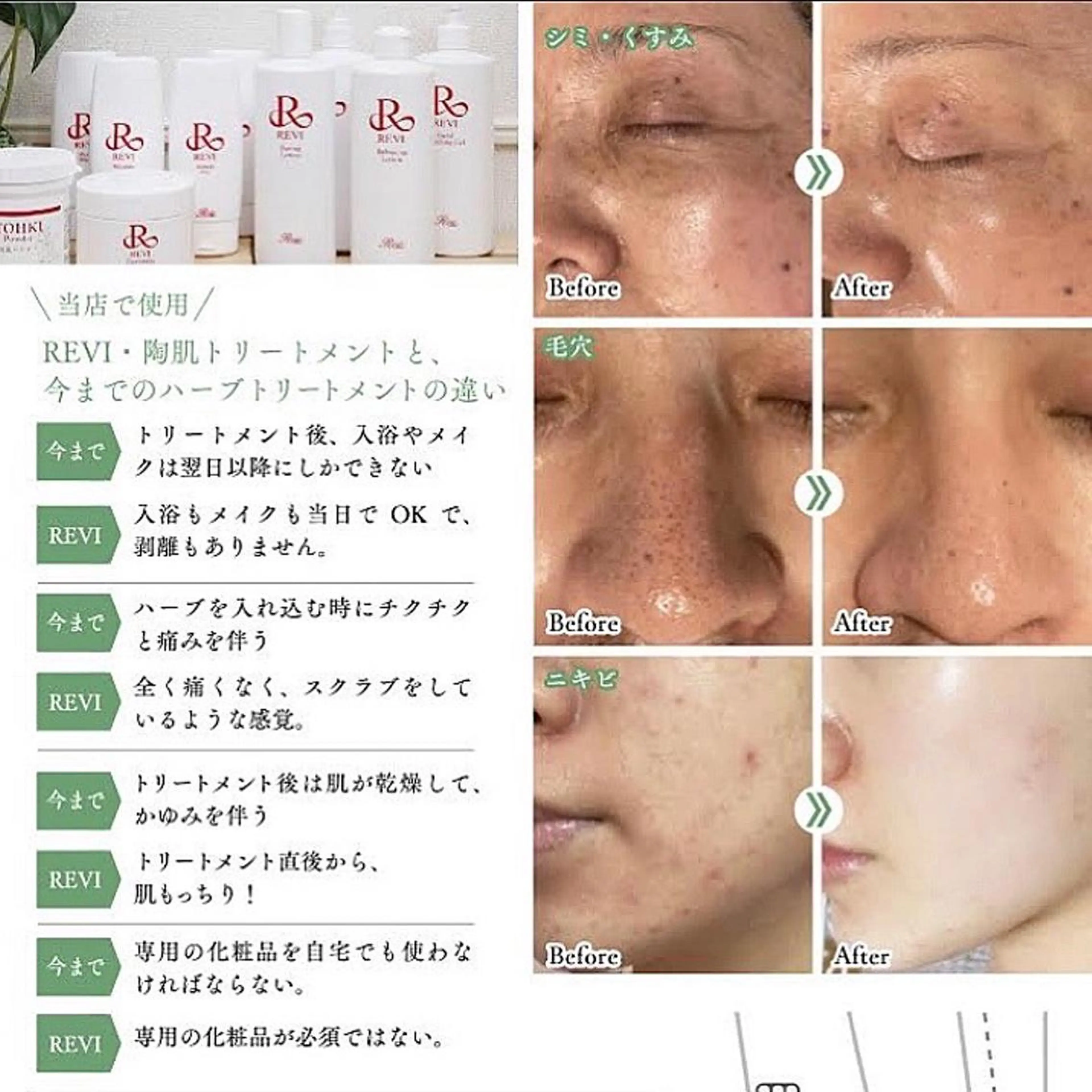 hm NATURESKINのエステ・リラクイメージ
