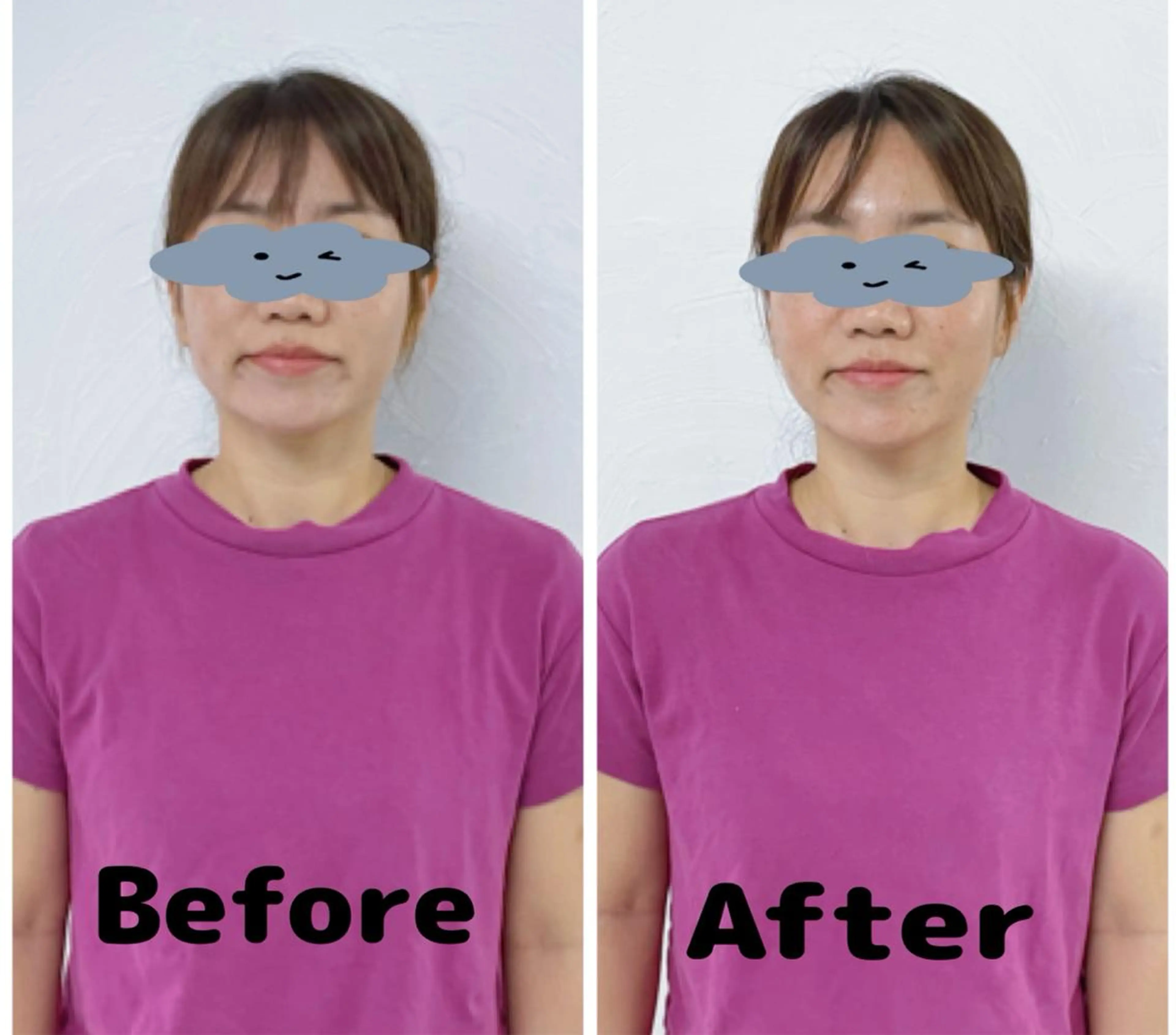 hapi_chura 《ハピちゅら》のエステ・リラクイメージ