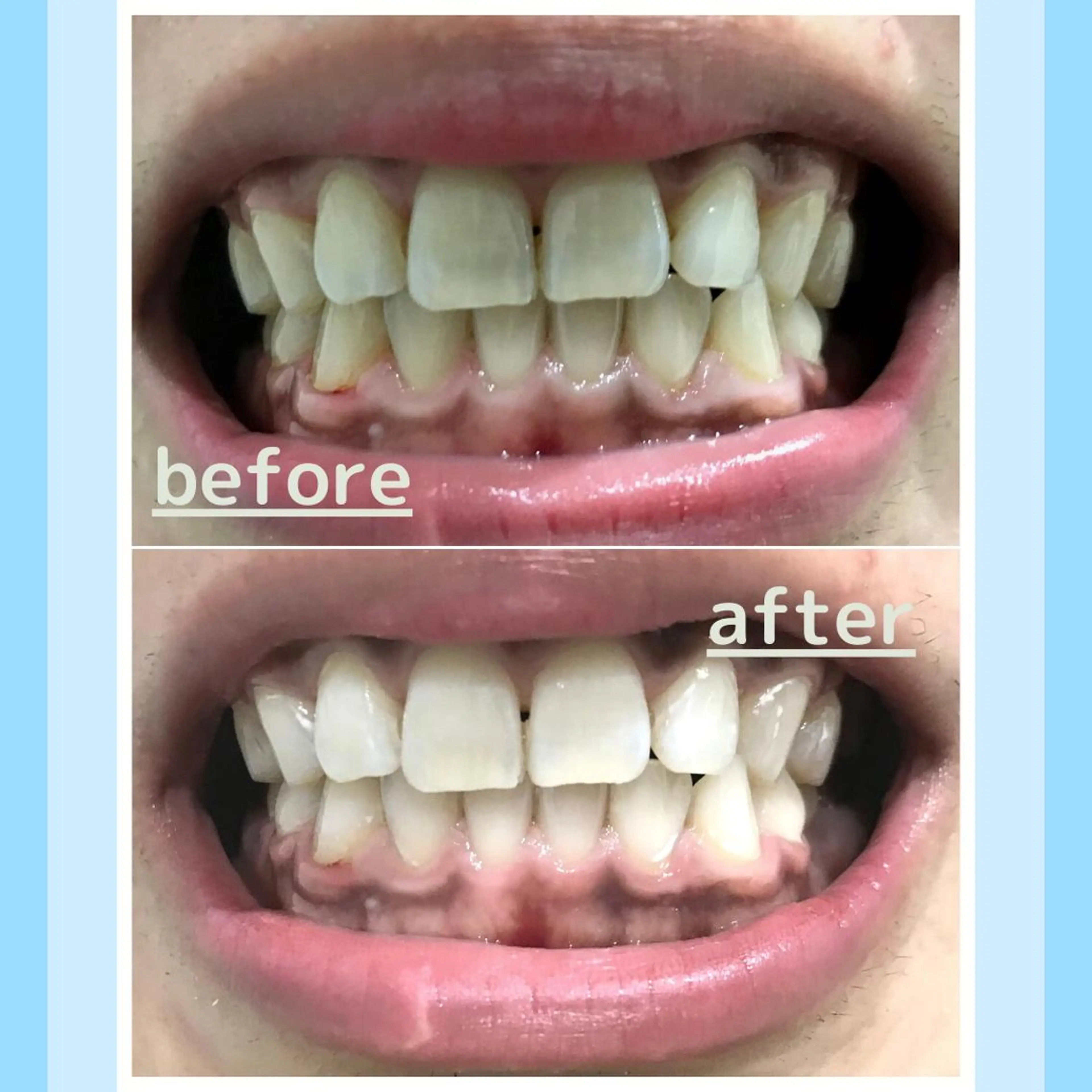 メンズ お手軽ホワイトニングsalon mina所属・武元 奈津美のその他イメージ