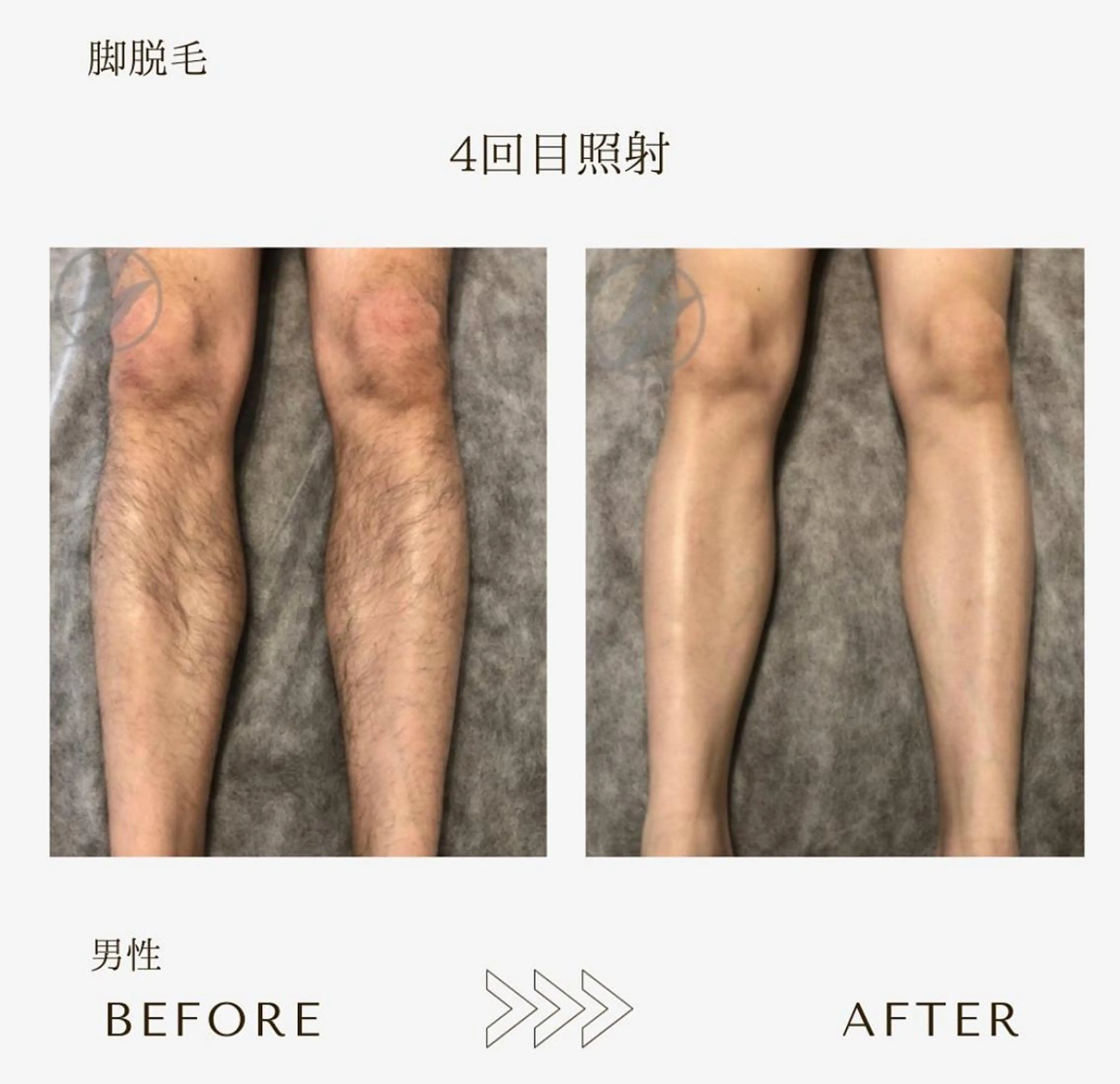 脱毛 本八幡salon83 ♡エイトミーのエステ・リラクイメージ