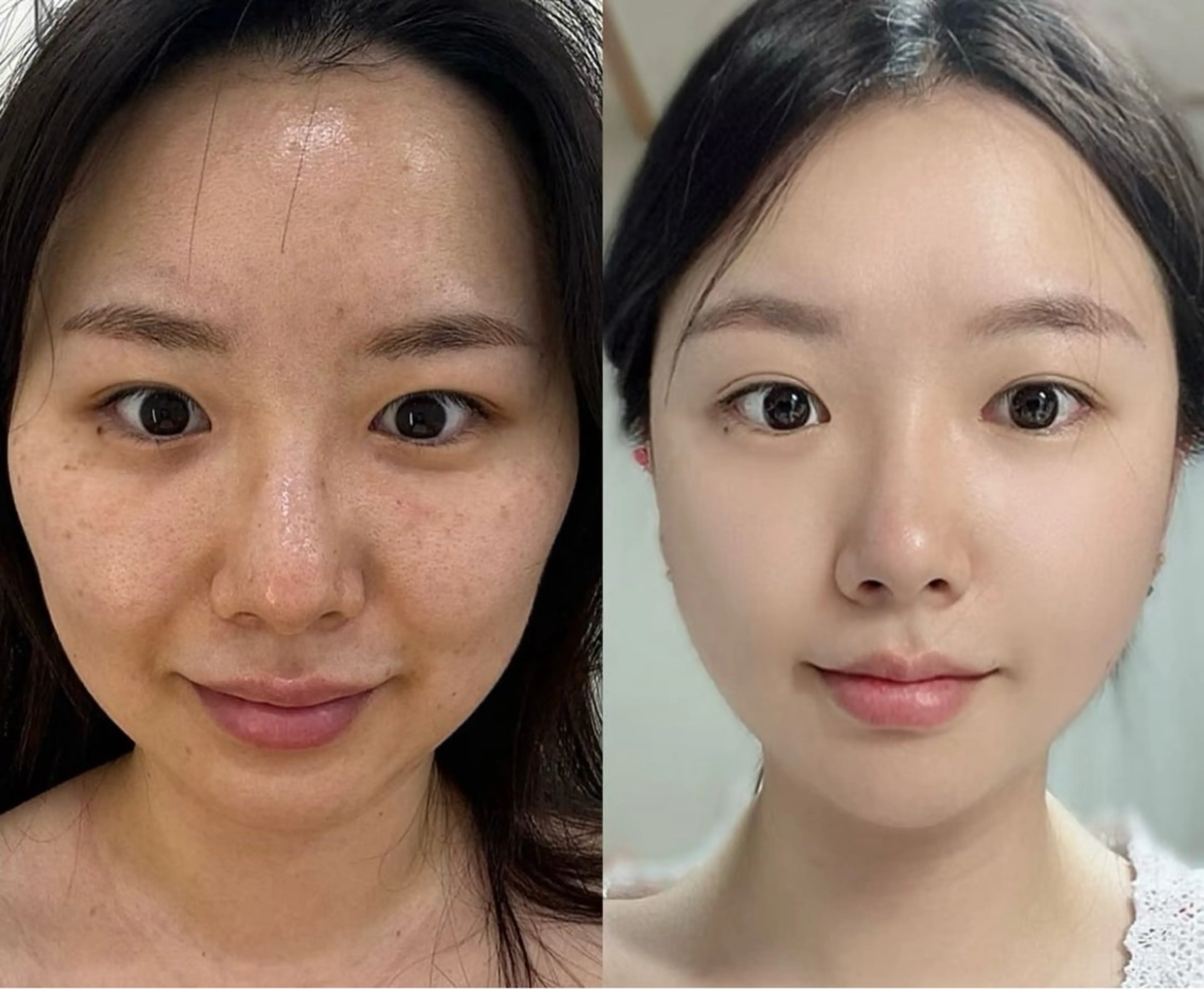 ネイル エステ aliaハイフ&水光ジェットサロン所属・aliaハーブ水光店 エステティシャン募集のエステ・リラクイメージ