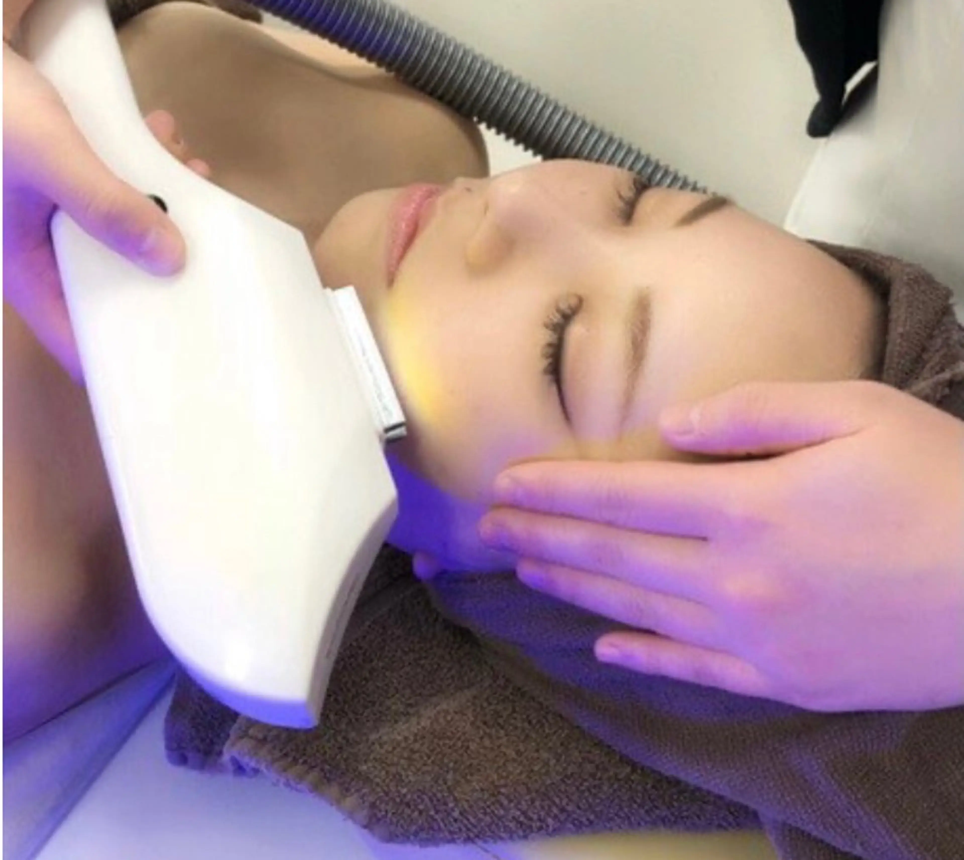 当店大人気！💎IPL光フェイシャル💆‍♀️(パック付)の写真