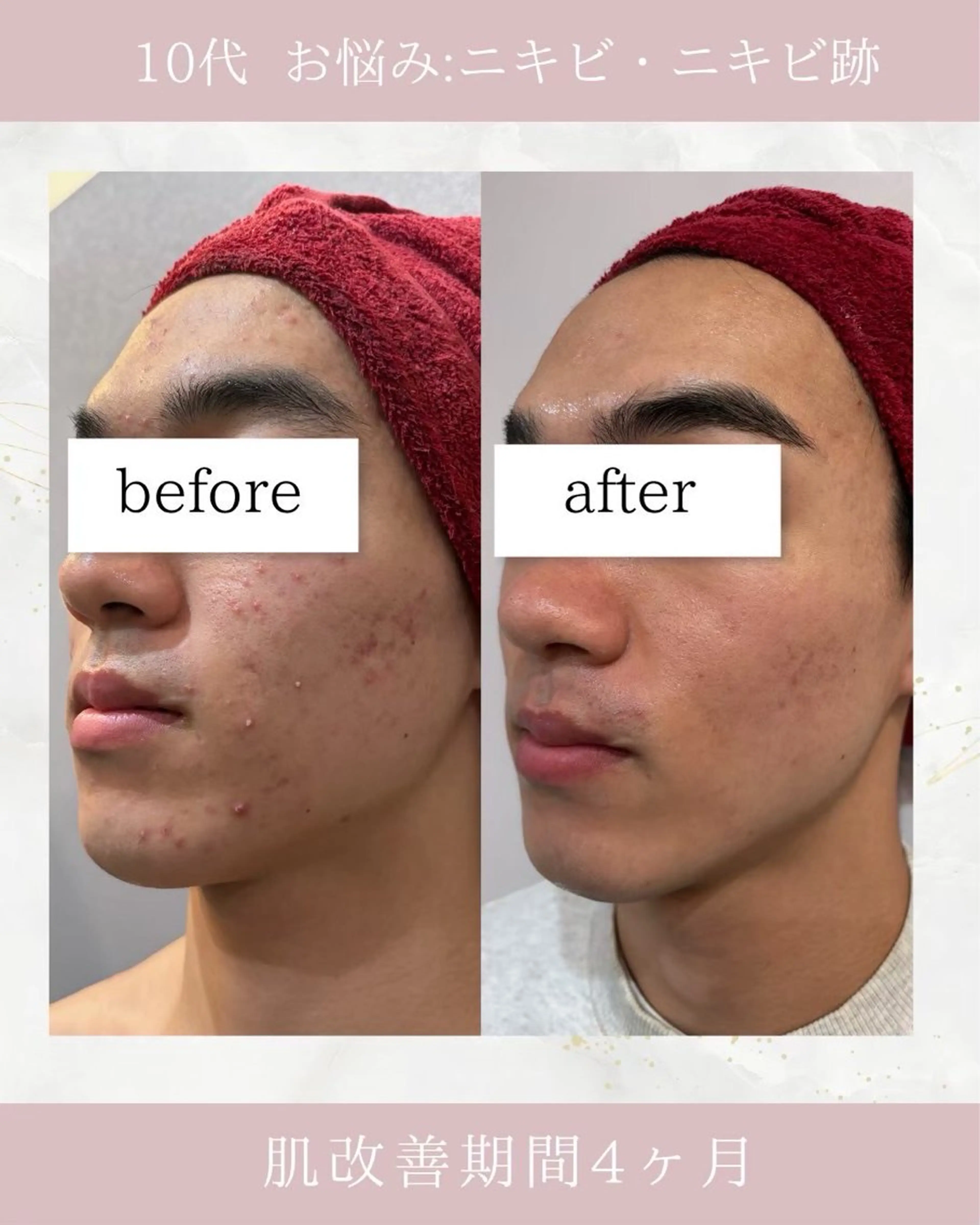 メンズ ARuru所属・ARuru 本店のエステ・リラクイメージ