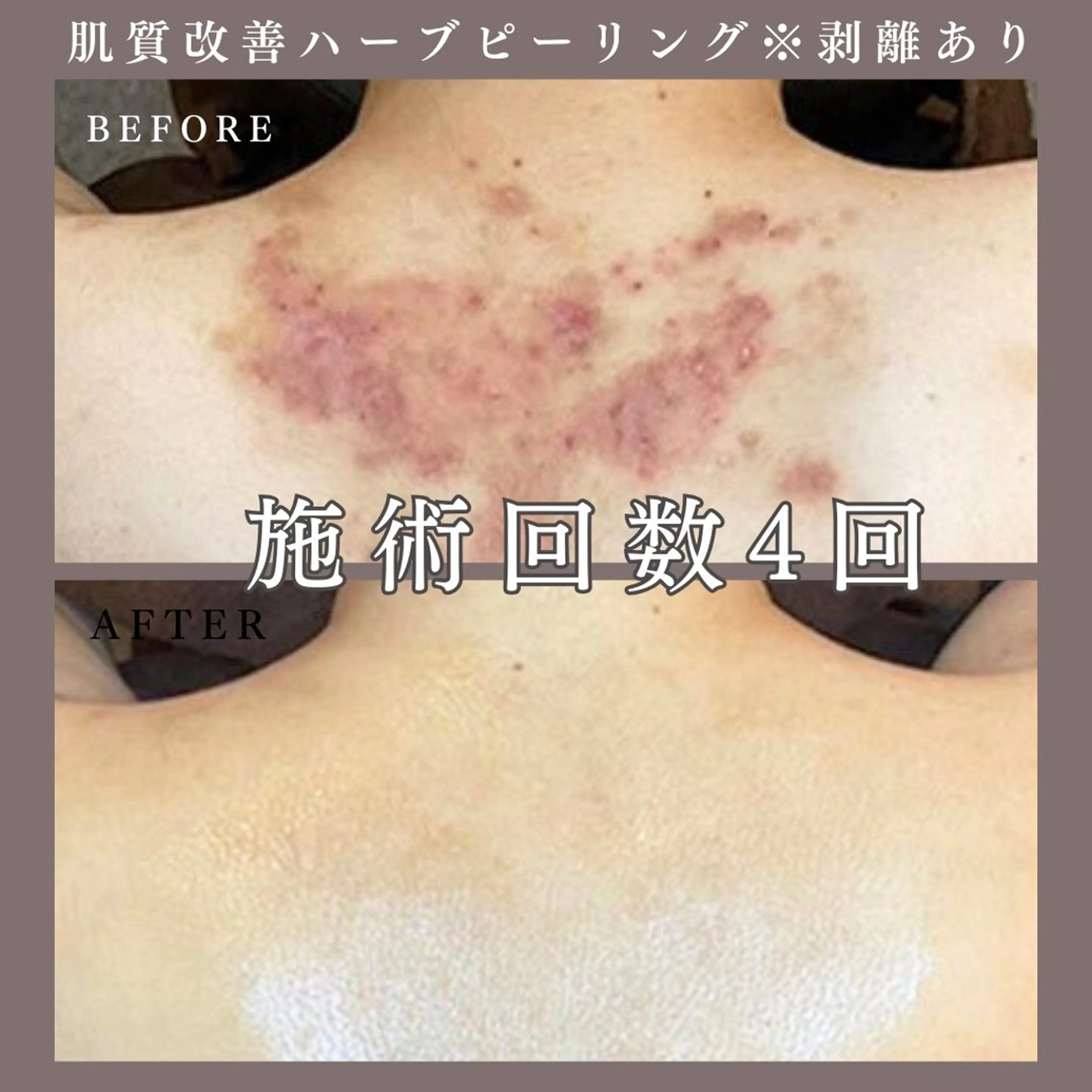 肌質改善専門サロン Bellmi/心斎橋のエステ・リラクイメージ