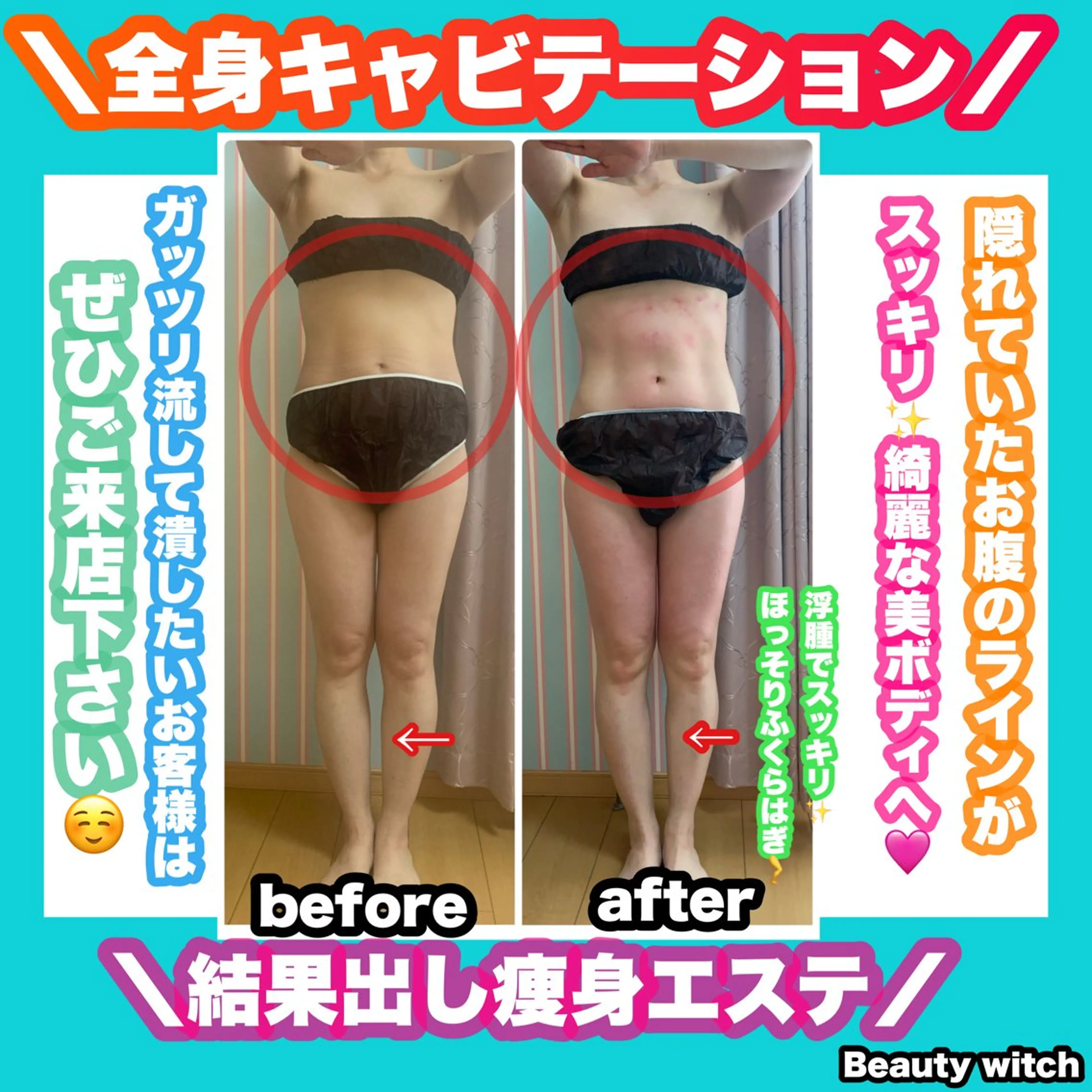 エステ リラク 痩身/脱毛/ネイル HARUKAのエステ・リラクイメージ