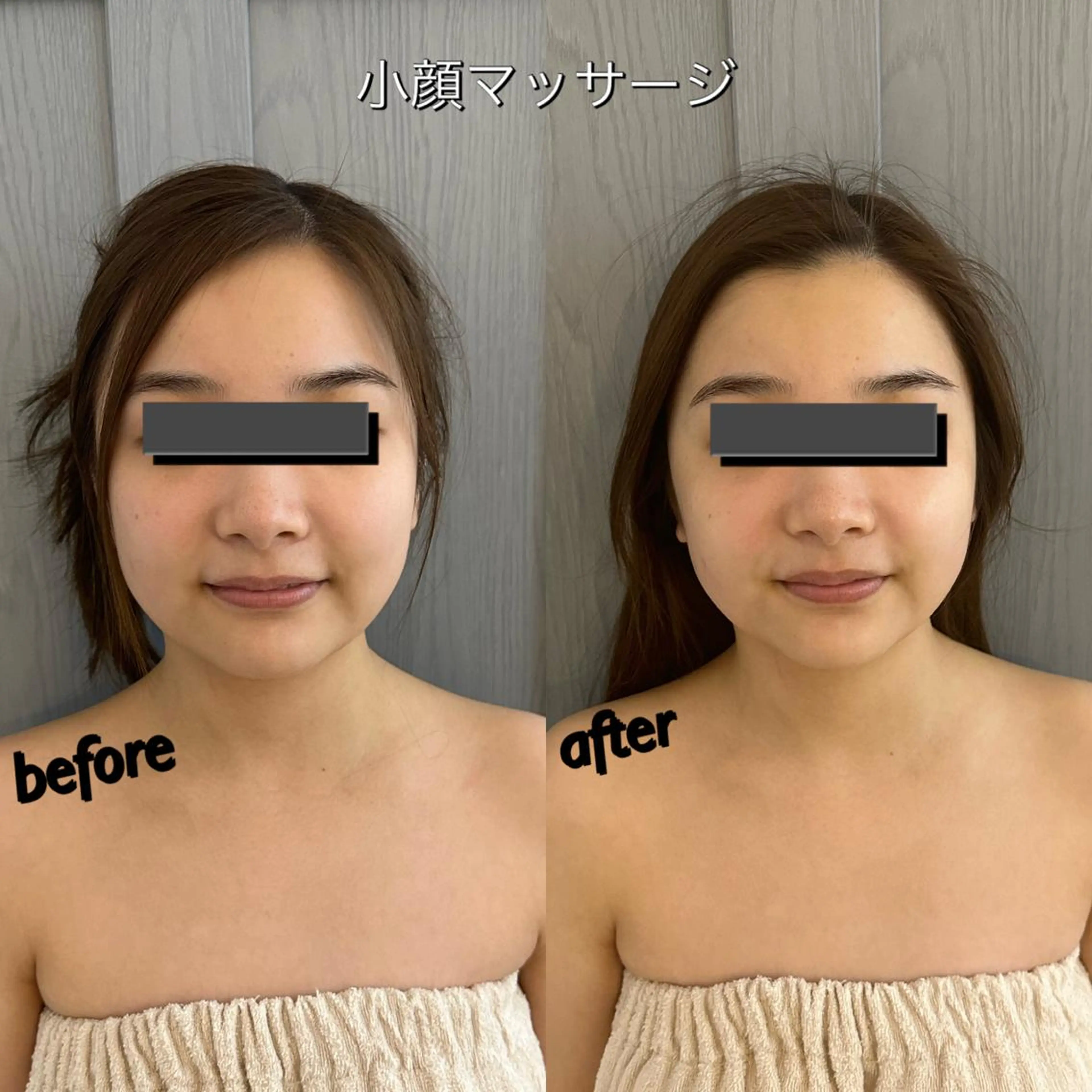 うなじ脱毛/美肌脱毛 LABELのエステ・リラクイメージ