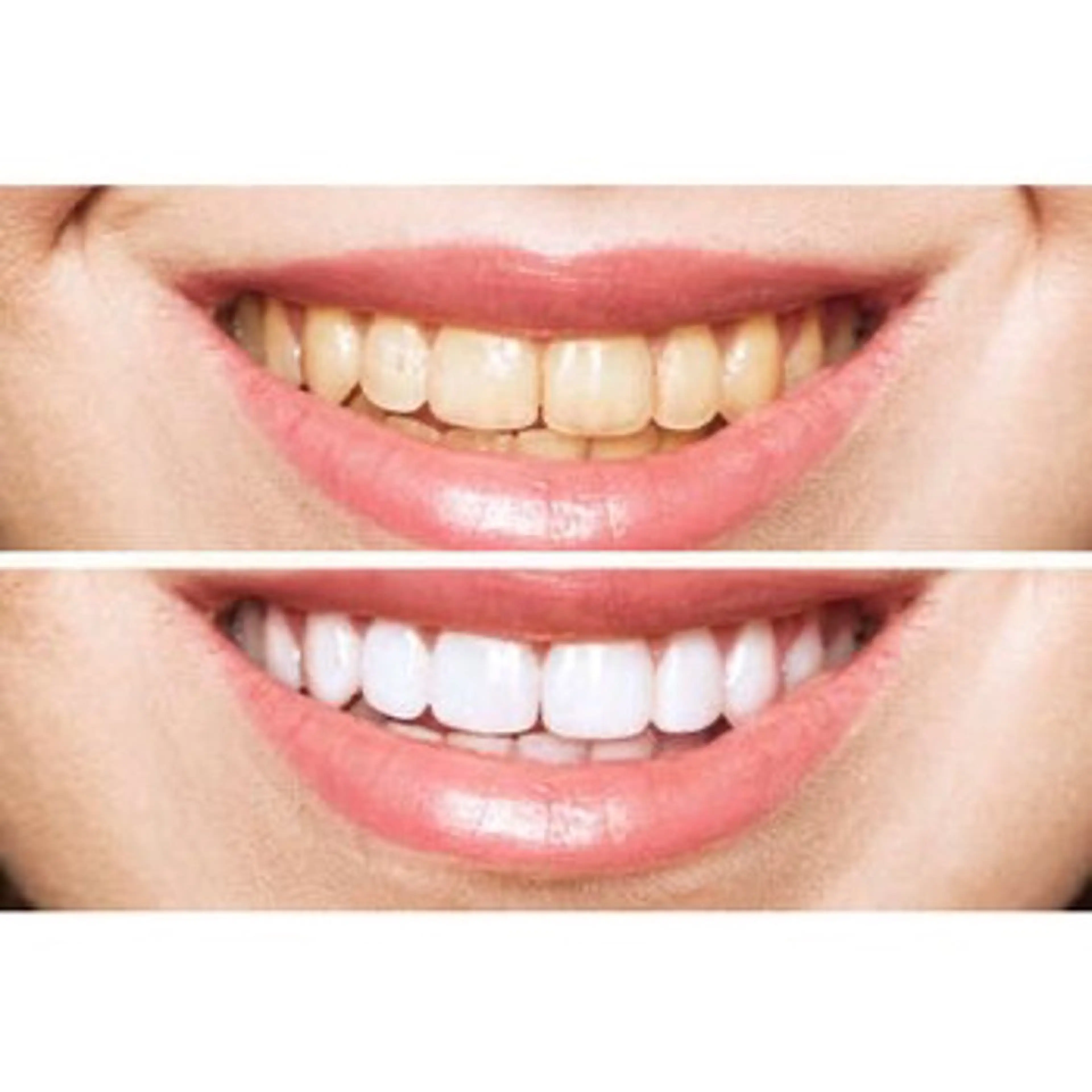 セルフホワイトニング エクシア大曽根店のその他イメージ