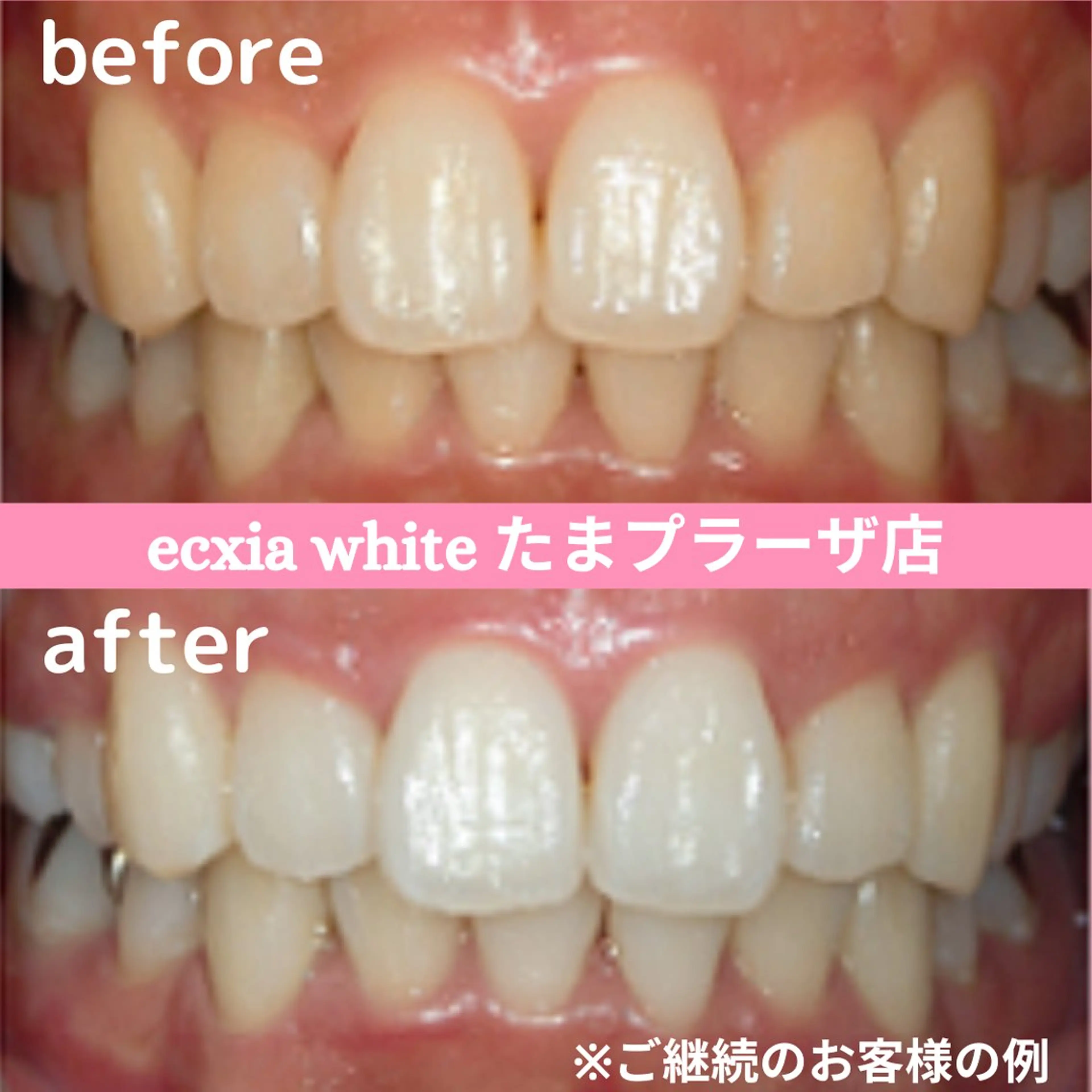 その他 セルフホワイトニング　エクシアたまプラーザ店所属・セルフホワイトニング エクシアたまプラーザのその他イメージ