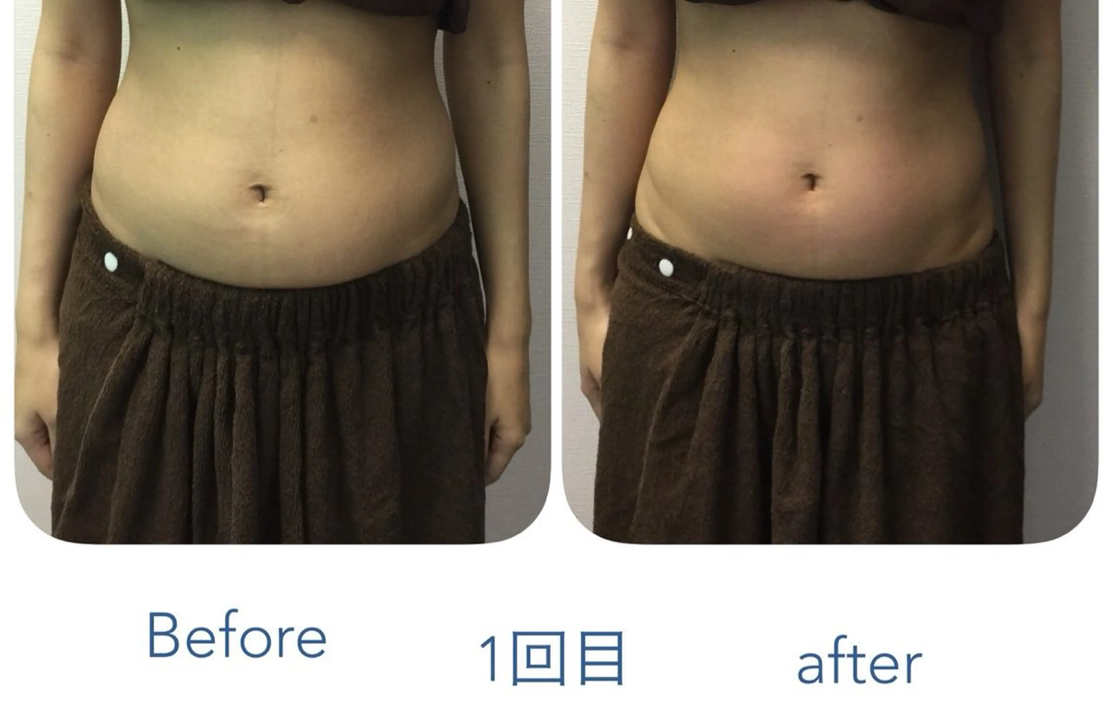 エステ エステサロンスマイリー所属・ｴｽﾃｻﾛﾝ ｽﾏｲﾘｰ後藤理恵のエステ・リラクイメージ