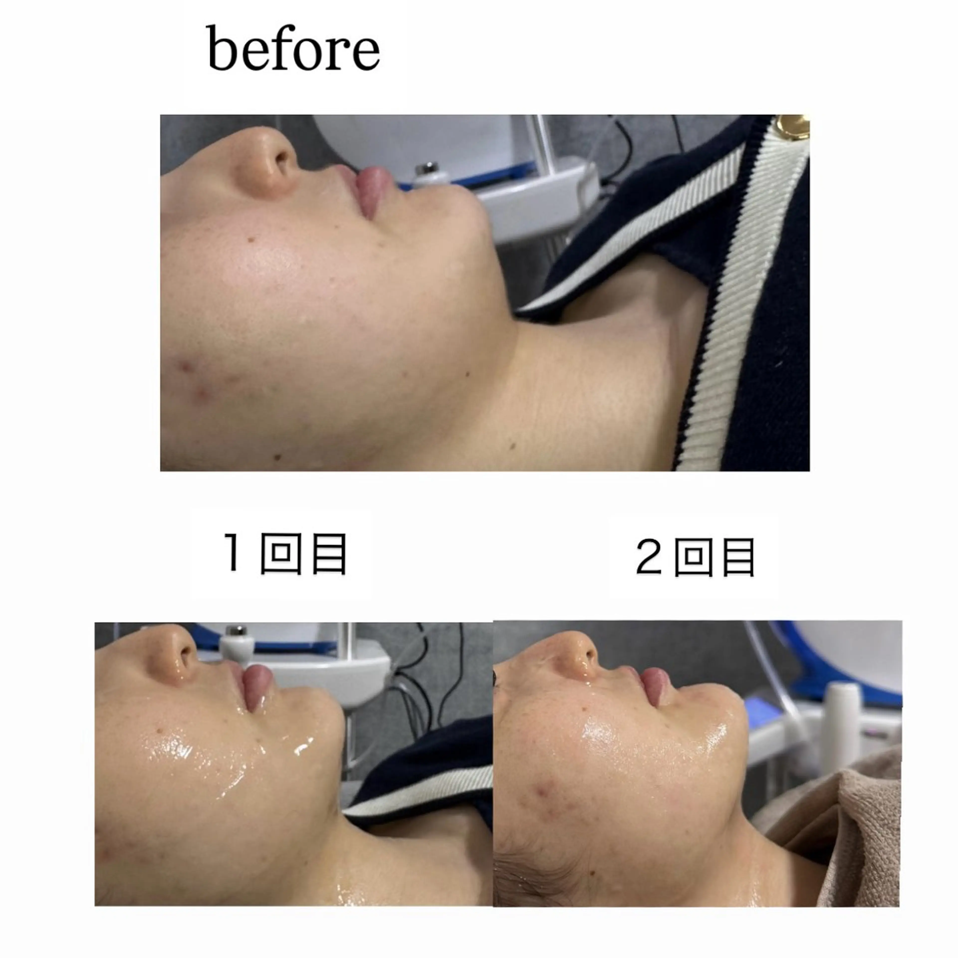 エステ crescent所属・【韓国肌管理・脱毛】 クレセントのエステ・リラクイメージ