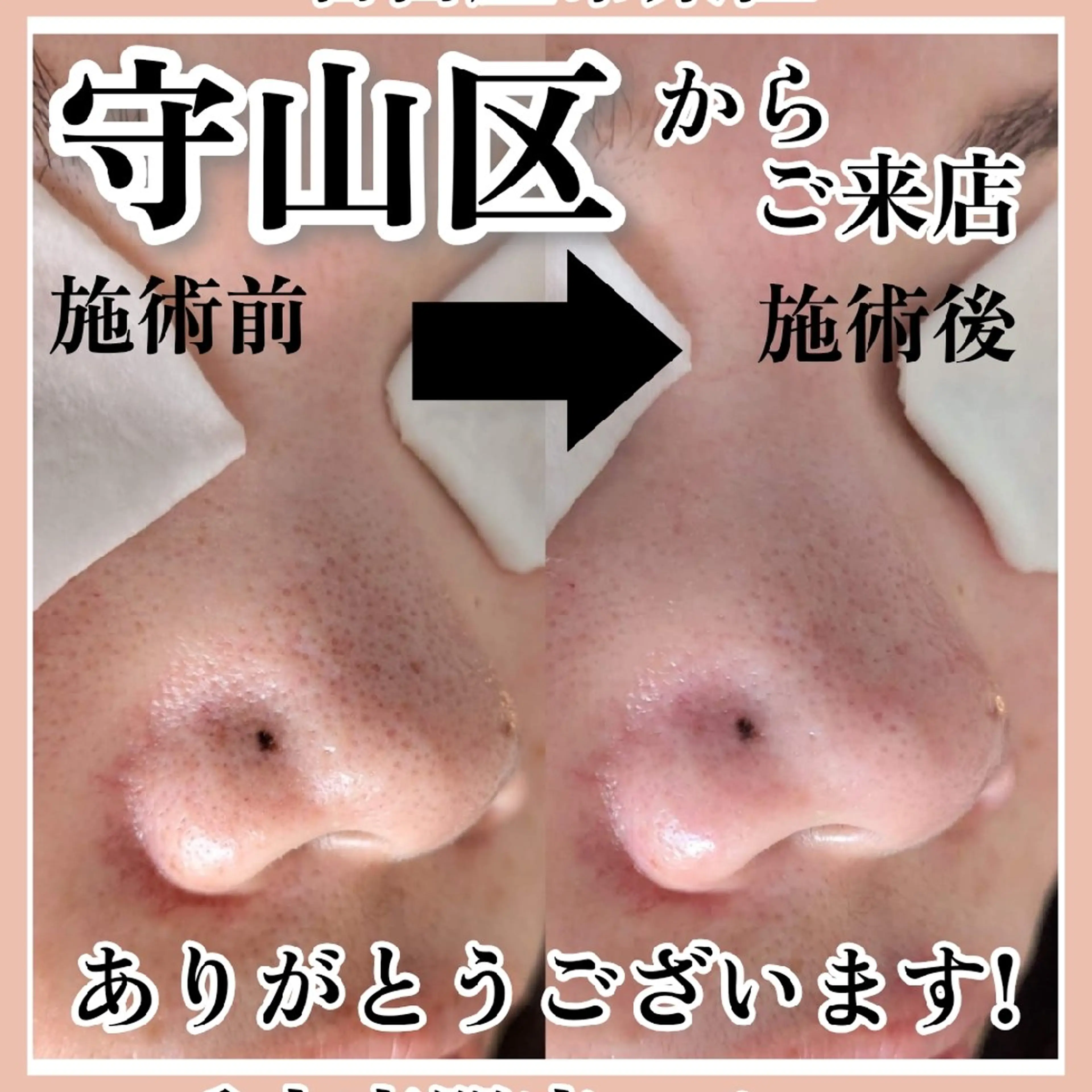  毛穴洗浄・まつ毛 の専門店 ソラーレのエステ・リラクイメージ