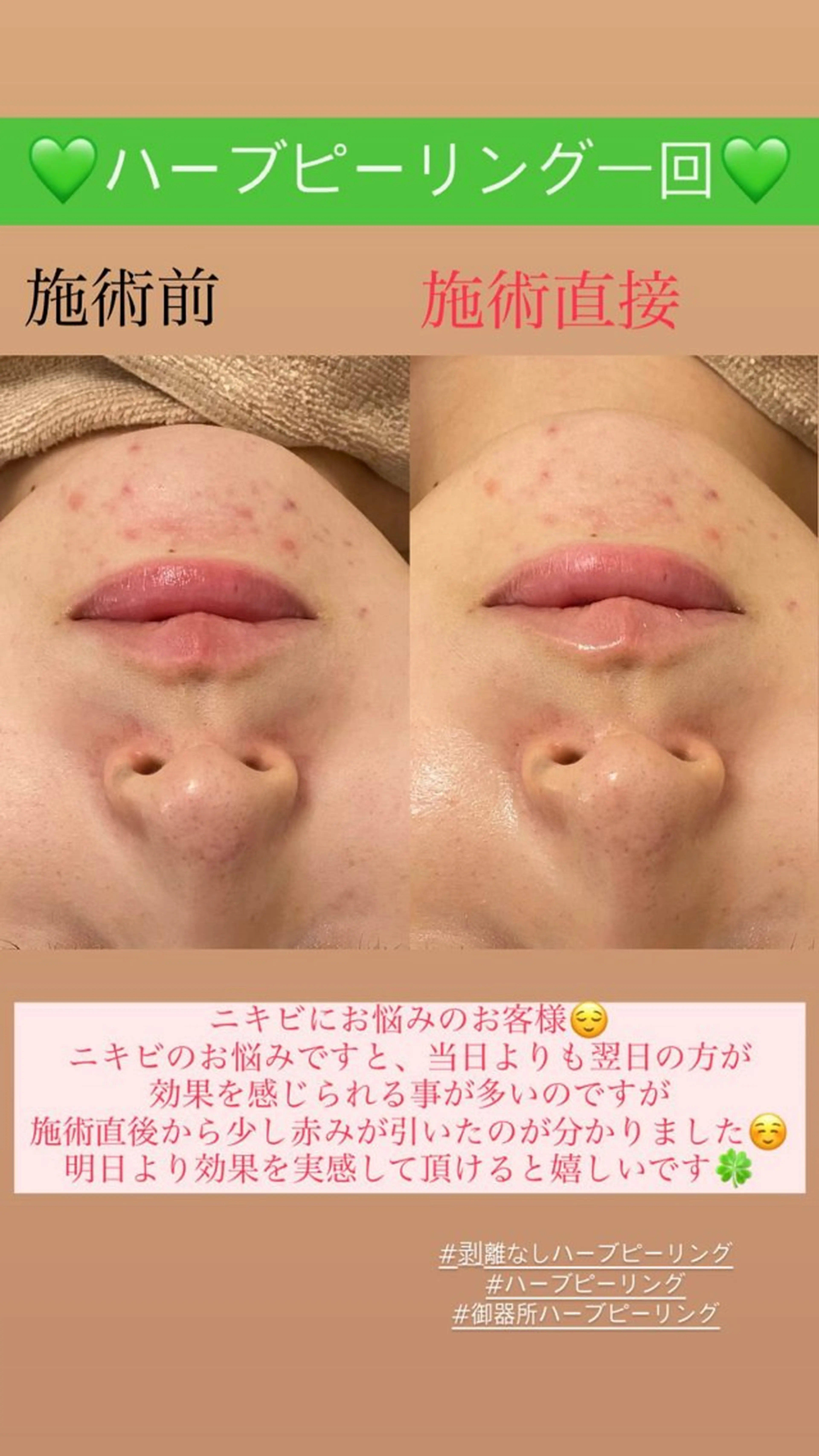 メンズ エステ Salon de Lino 御器所のエステ・リラクイメージ