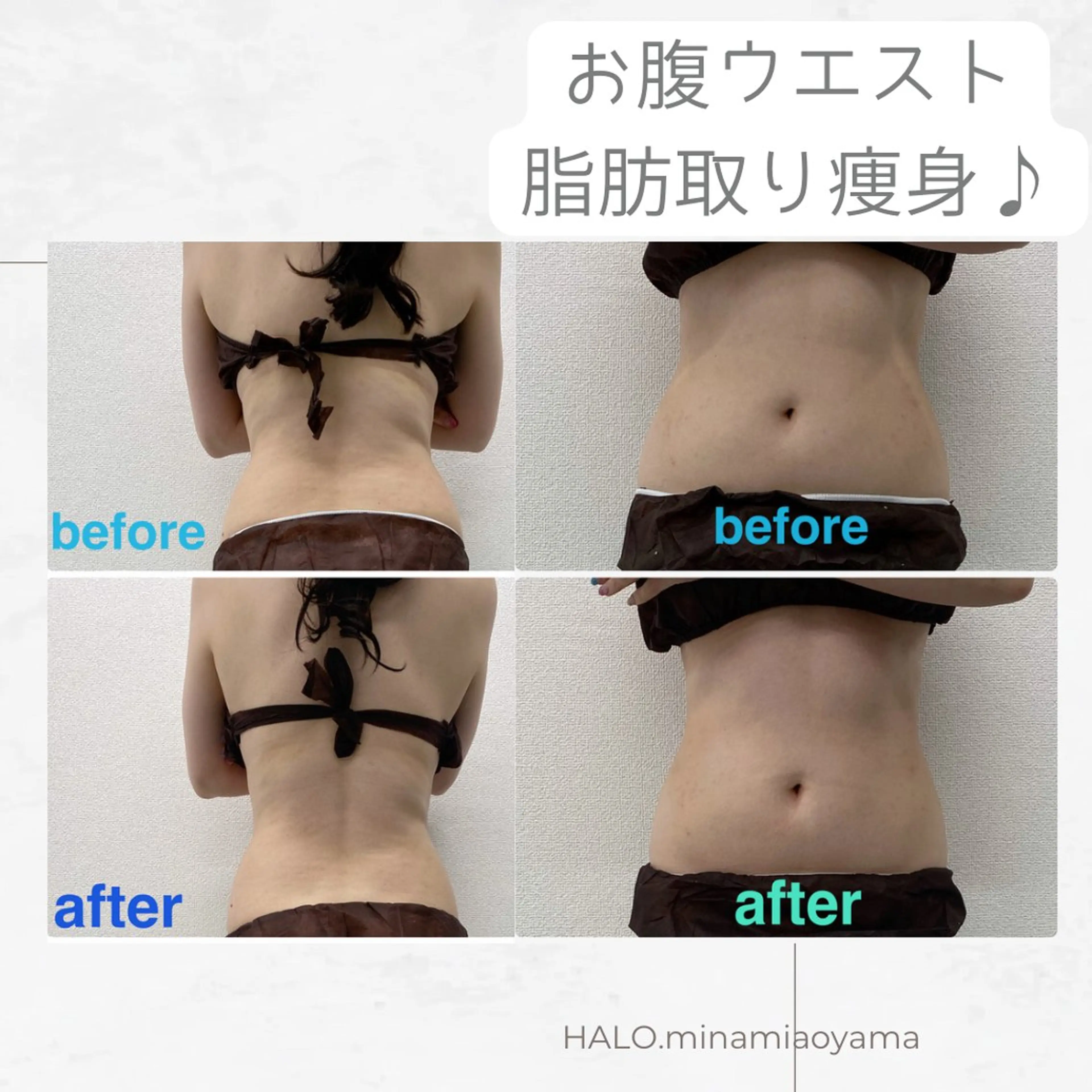 【６０分】お試しお腹ウエストスタンプ痩身１０Pの写真