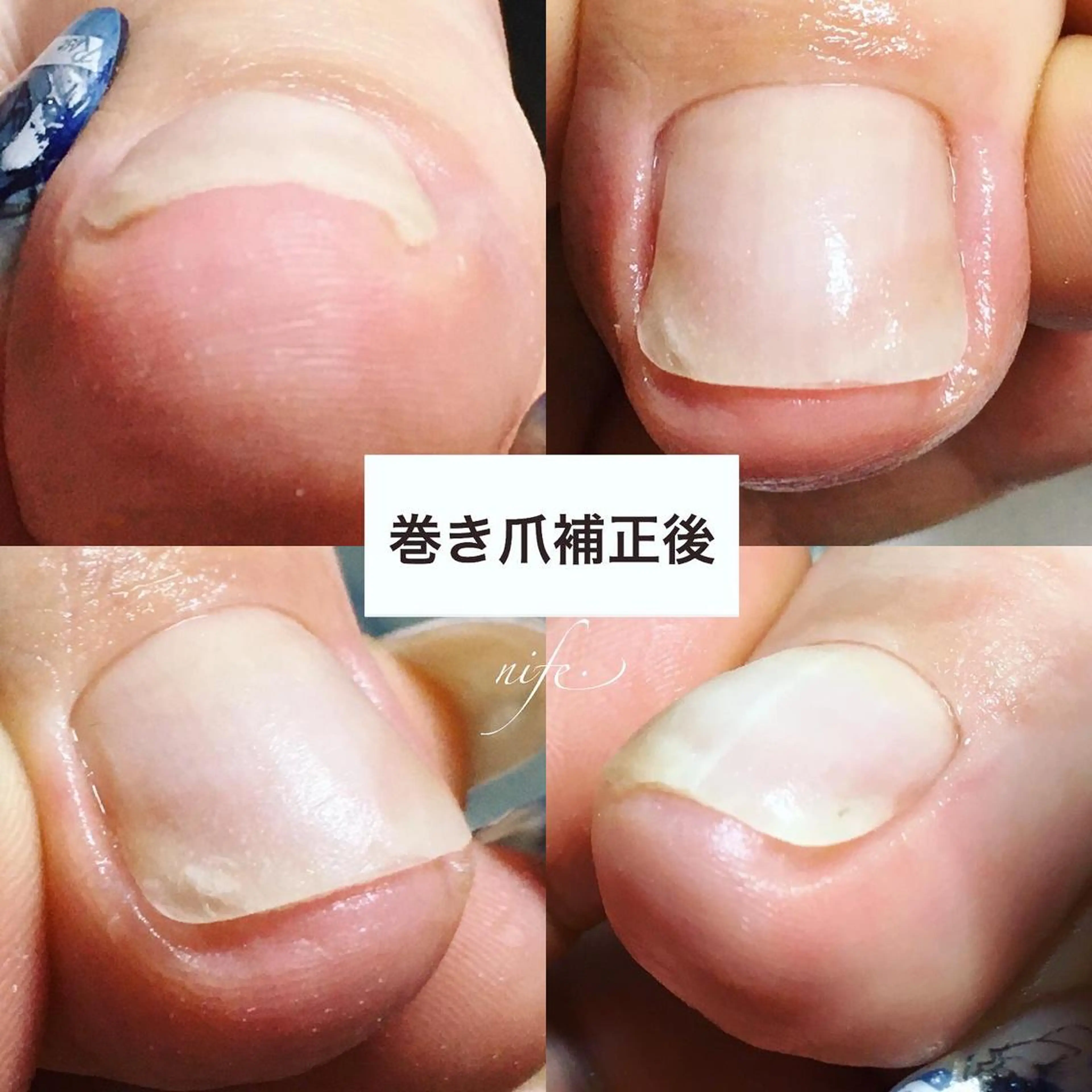 ネイル フットネイル atelier nife.のネイルデザイン