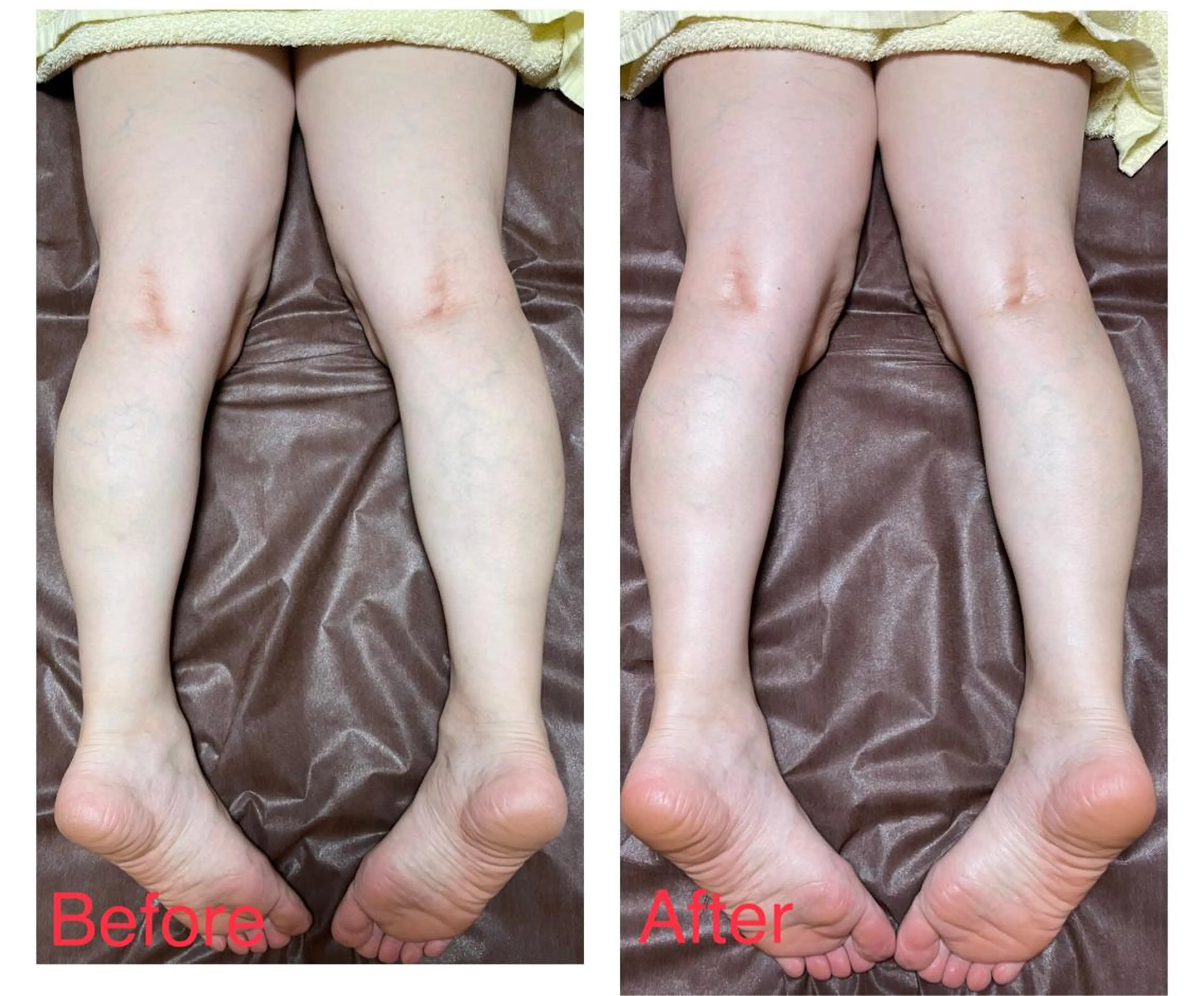 ハウオリベリー所属・うえば すみかのエステ・リラクイメージ