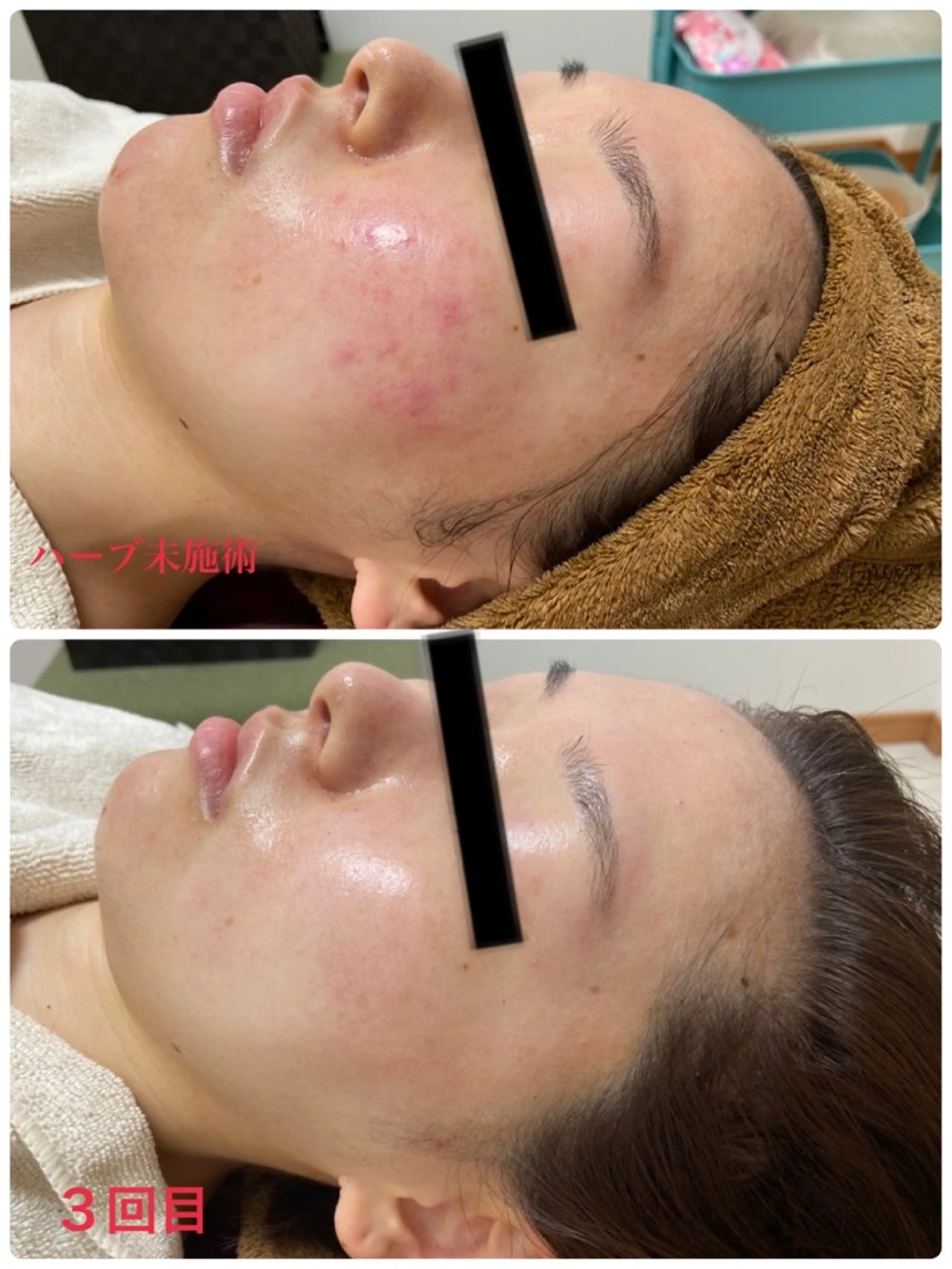 エステ REBORN by ami-goのその他イメージ