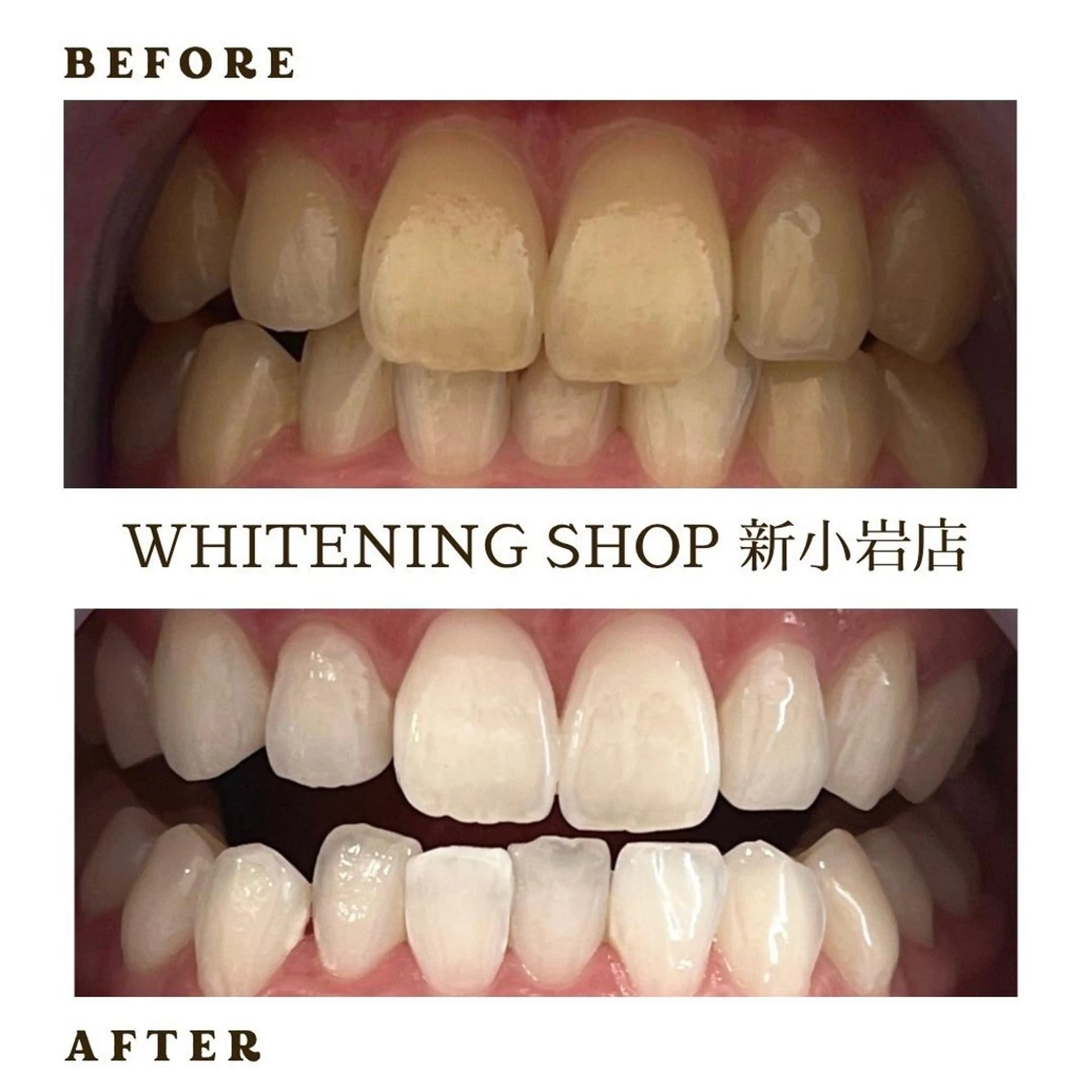 メンズ その他 ホワイトニング ショップ新小岩店のその他イメージ