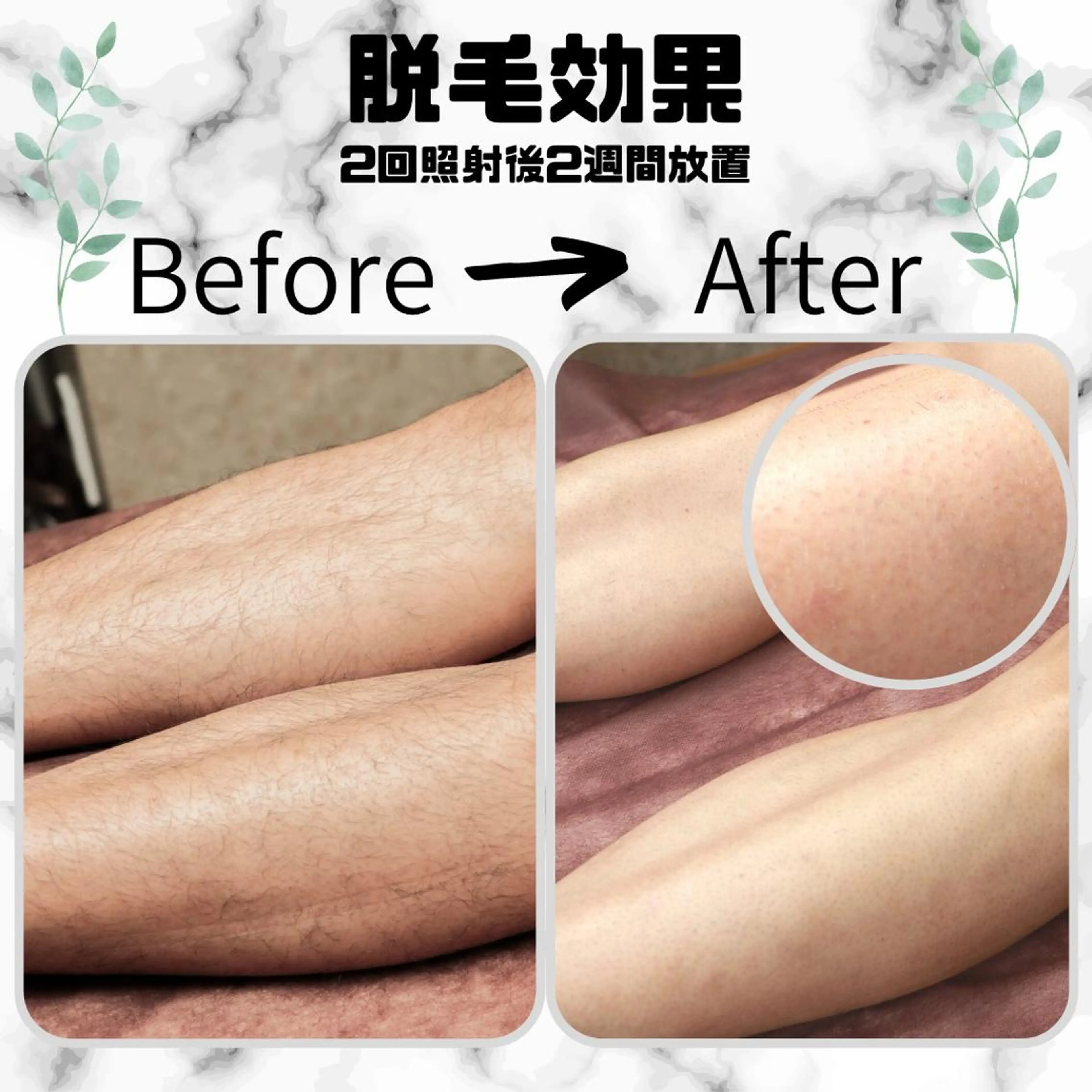 メンズ 男女同額脱毛エステ salonLEPIAのエステ・リラクイメージ