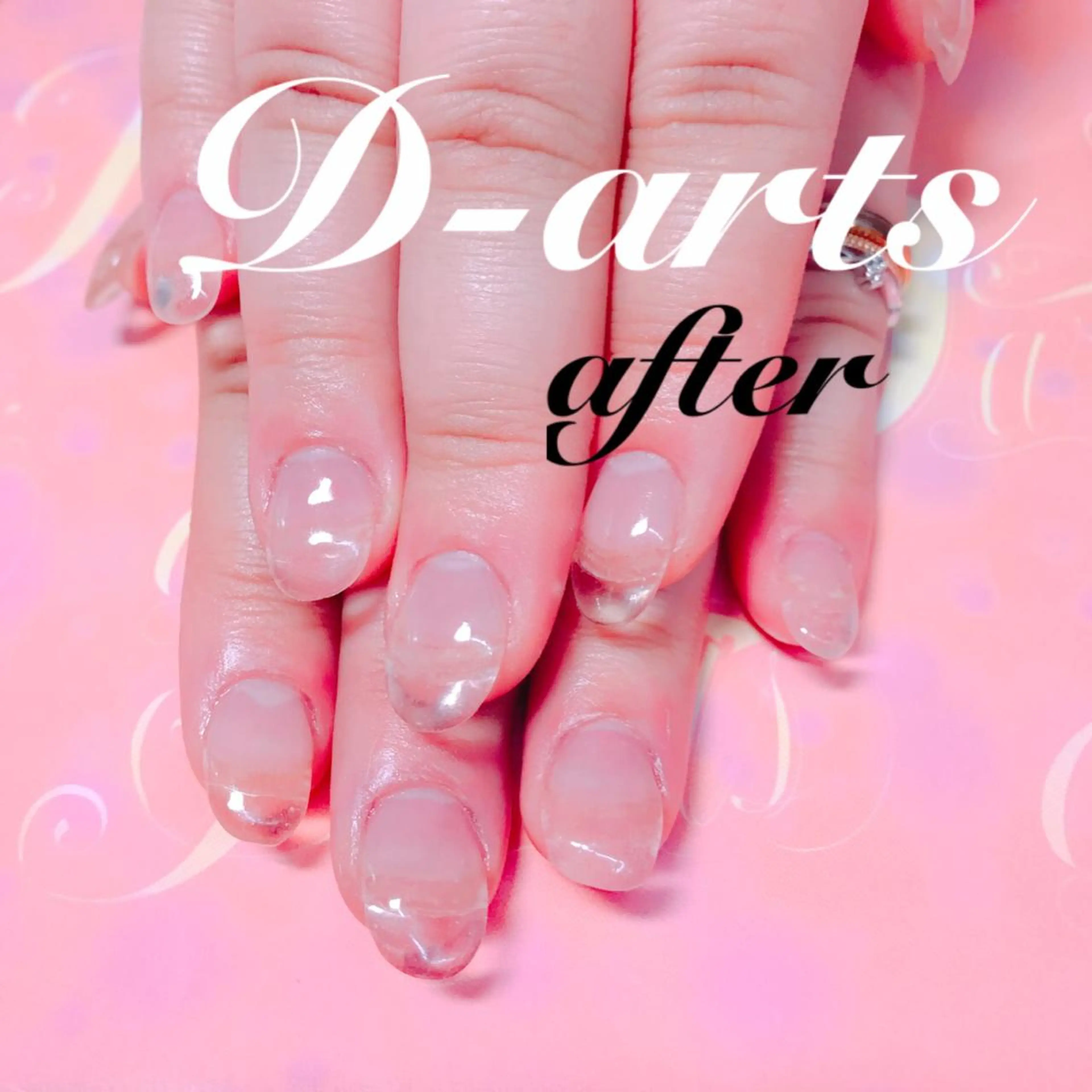 ネイル 長さ出し S&S 村田小百合のネイルデザイン