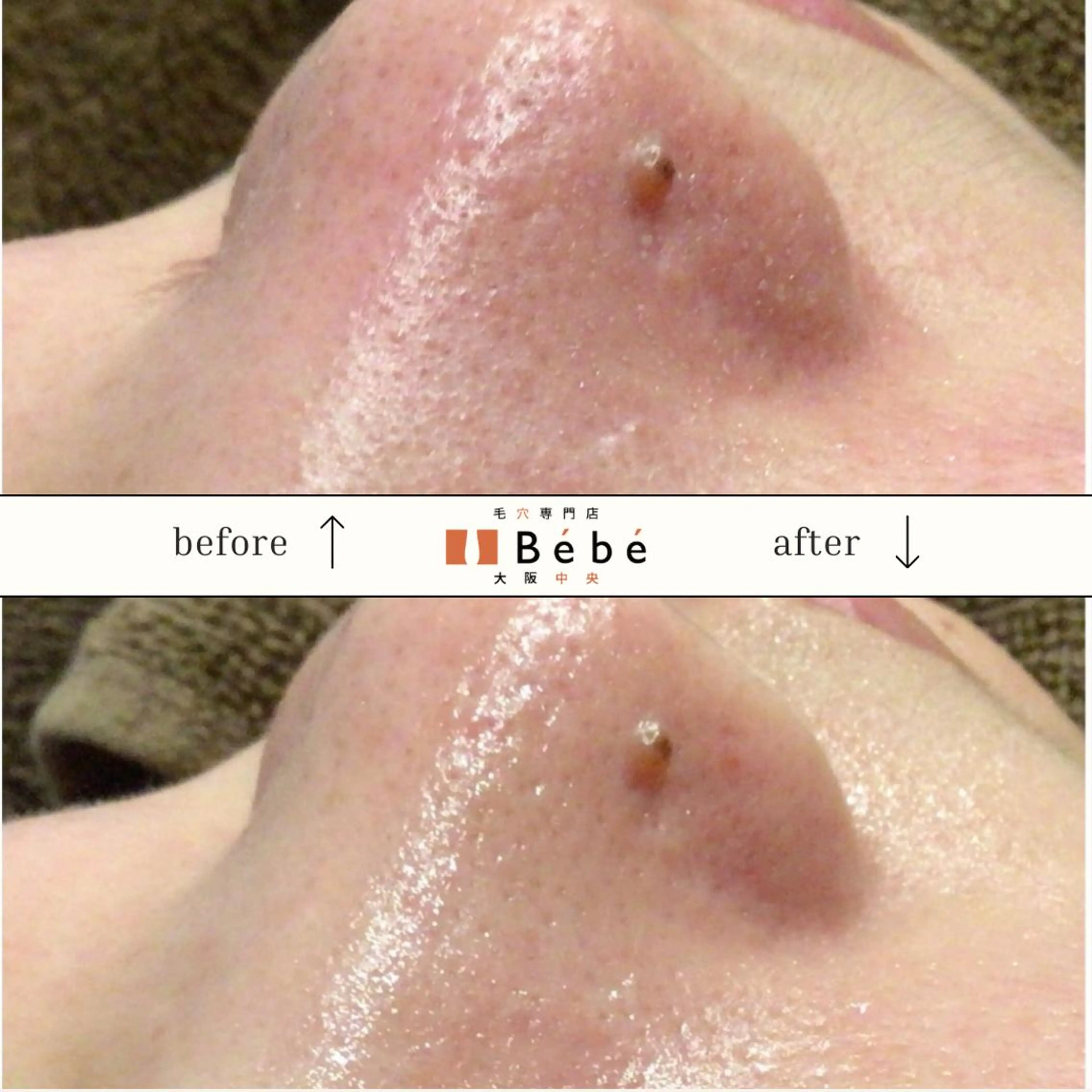 毛穴専門店Bébé 大阪中央店のエステ・リラクイメージ