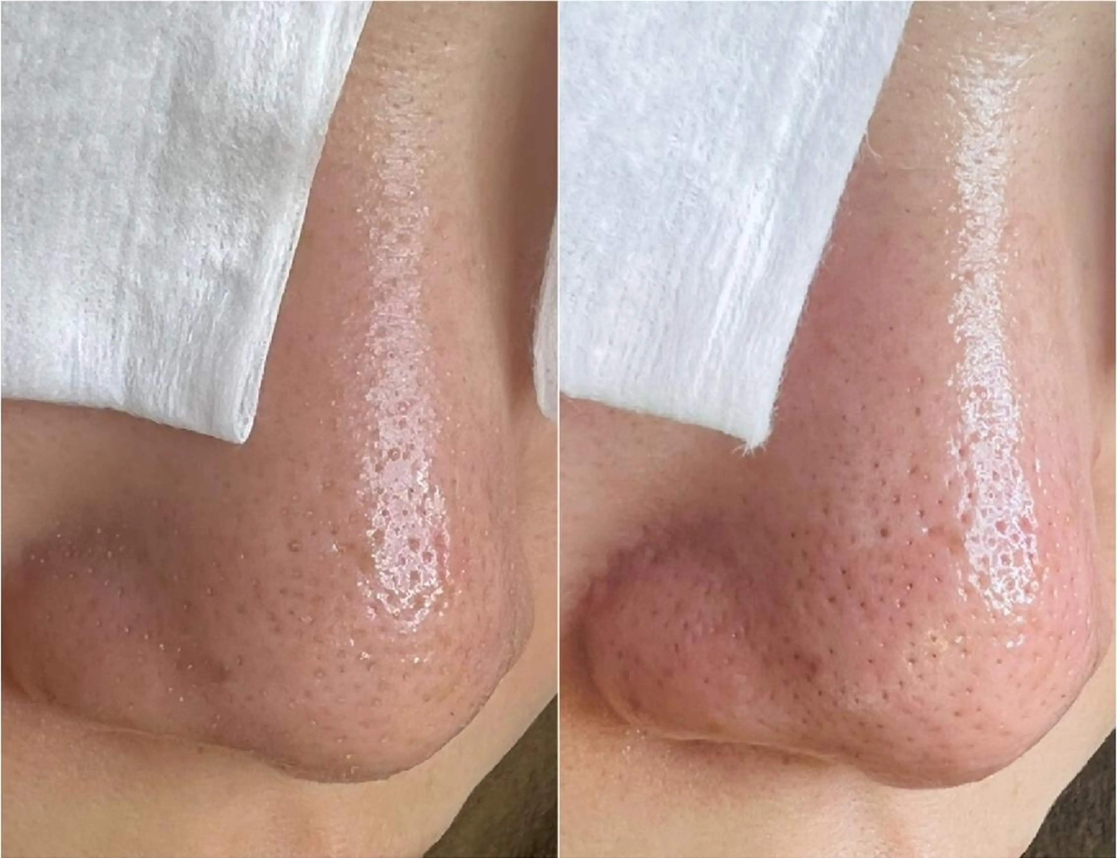 エステ Lipula リプラ所属・毛穴ツヤ肌専門    Lipulaのエステ・リラクイメージ