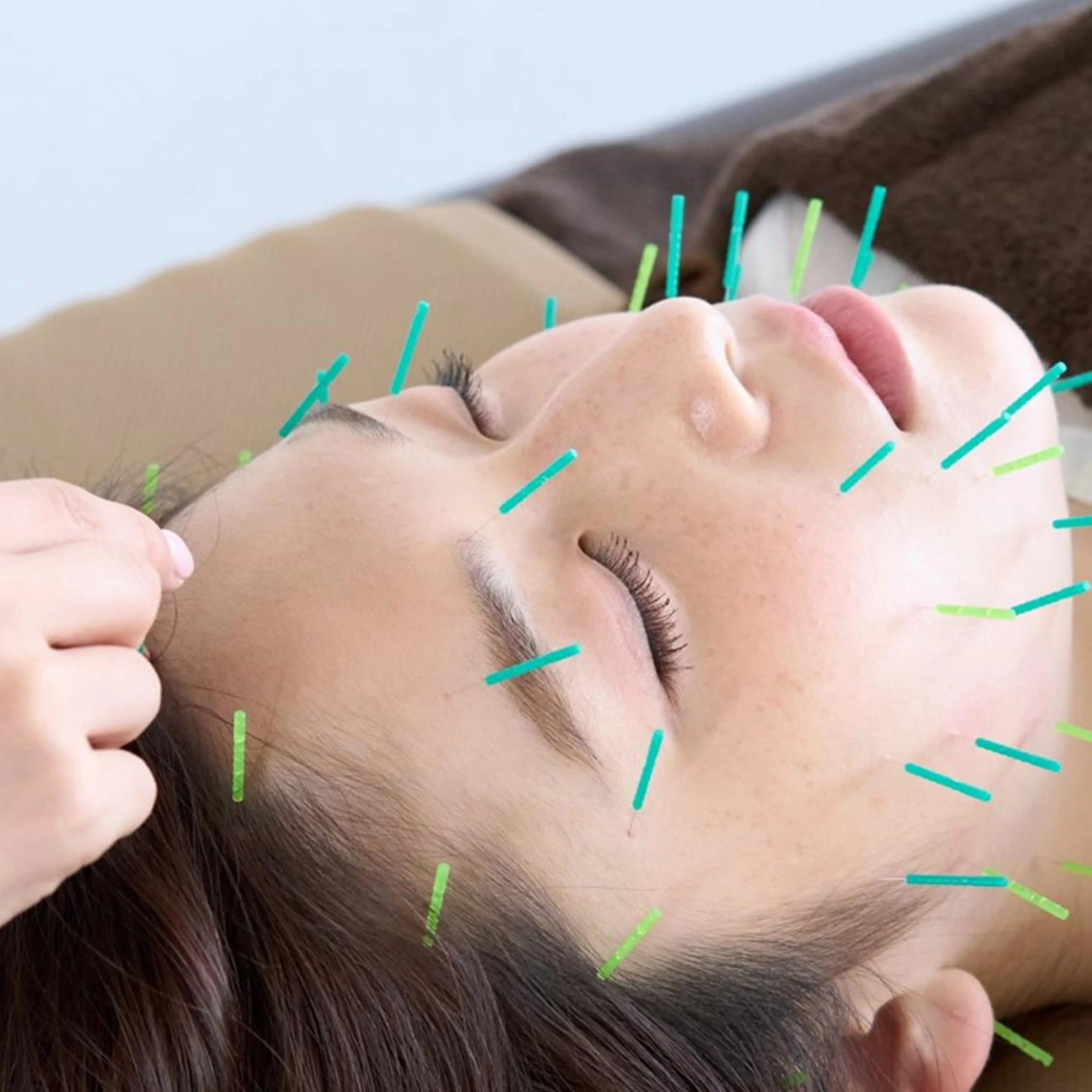 美容鍼50本＋小顔マッサージ＋保湿仕上げの写真