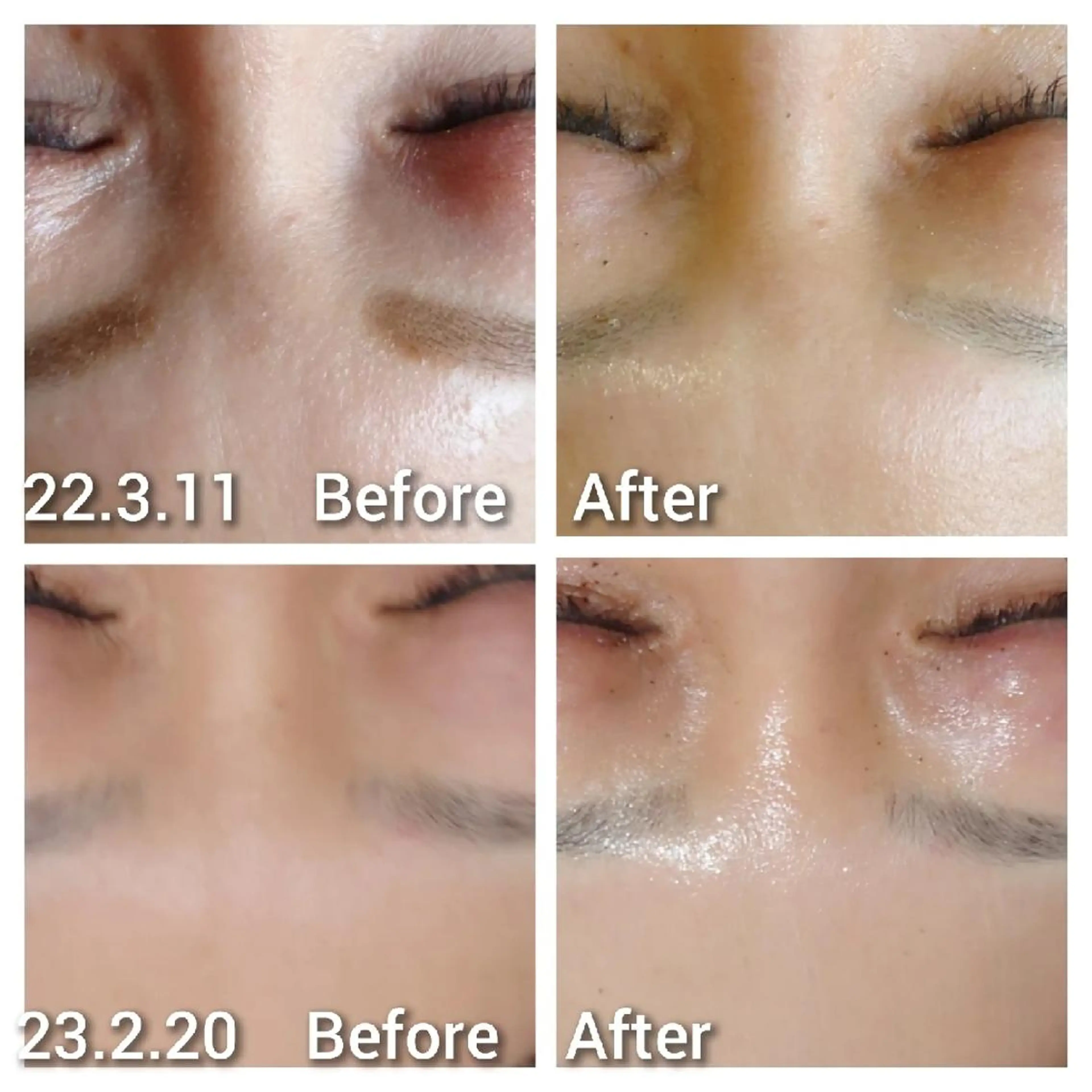 エステ Beauty Salon Luana所属・Luanaまつパ脱毛 ハーブピーリング眉毛のマツエク・マツパデザイン