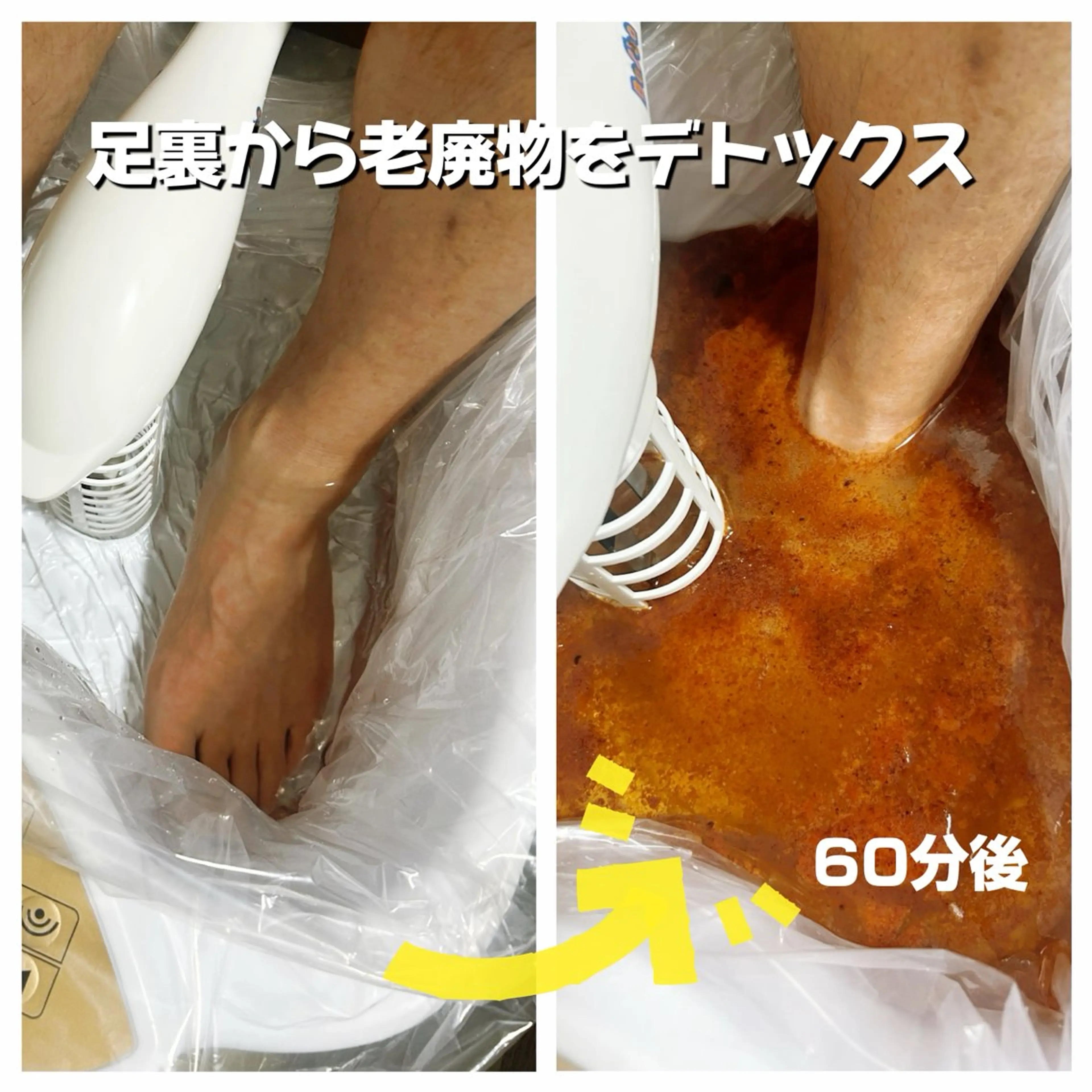 ゴッドクリーナーゴールド60分　初回限定の写真