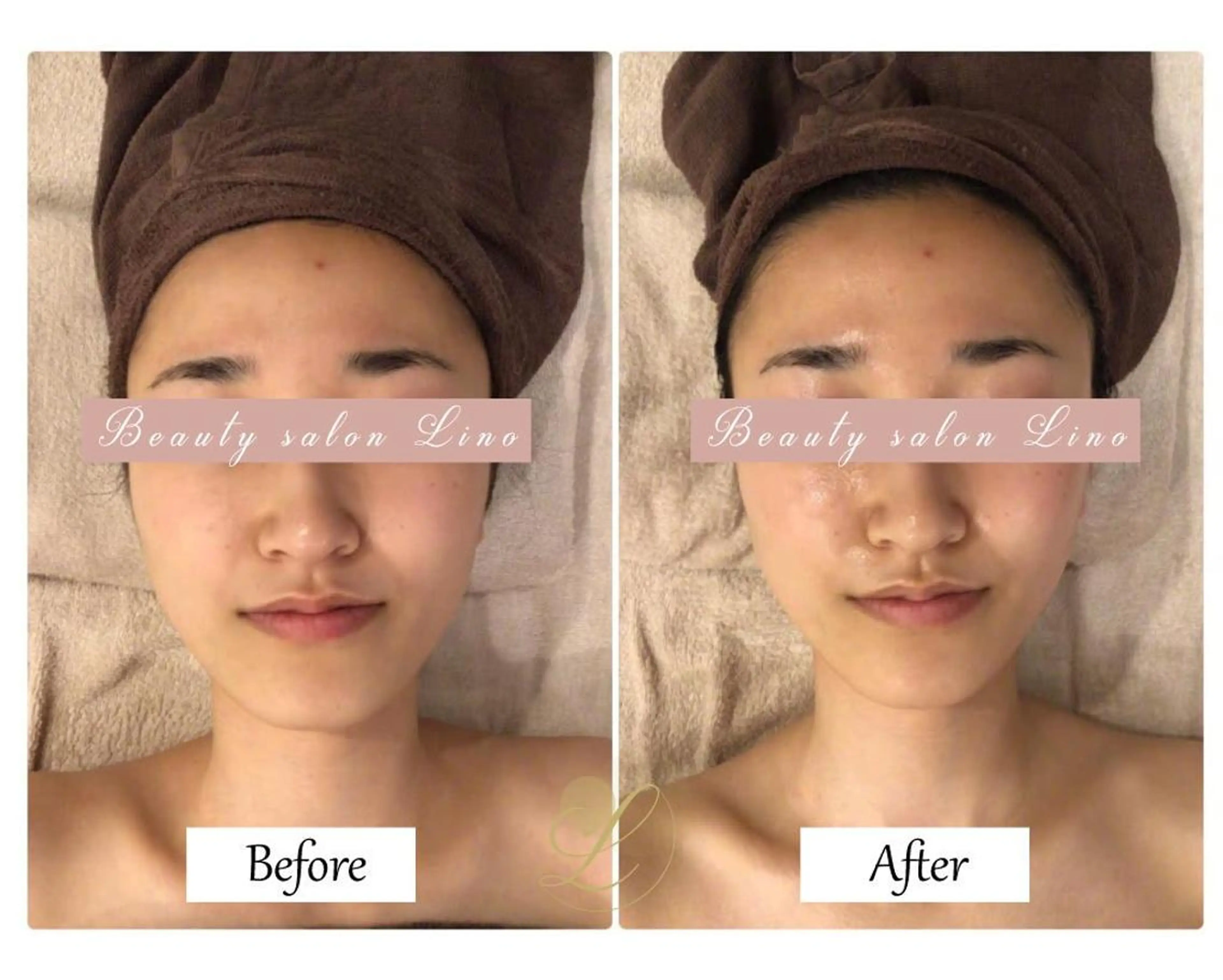 ブライダルサロン ｜Lino【堀江】のエステ・リラクイメージ