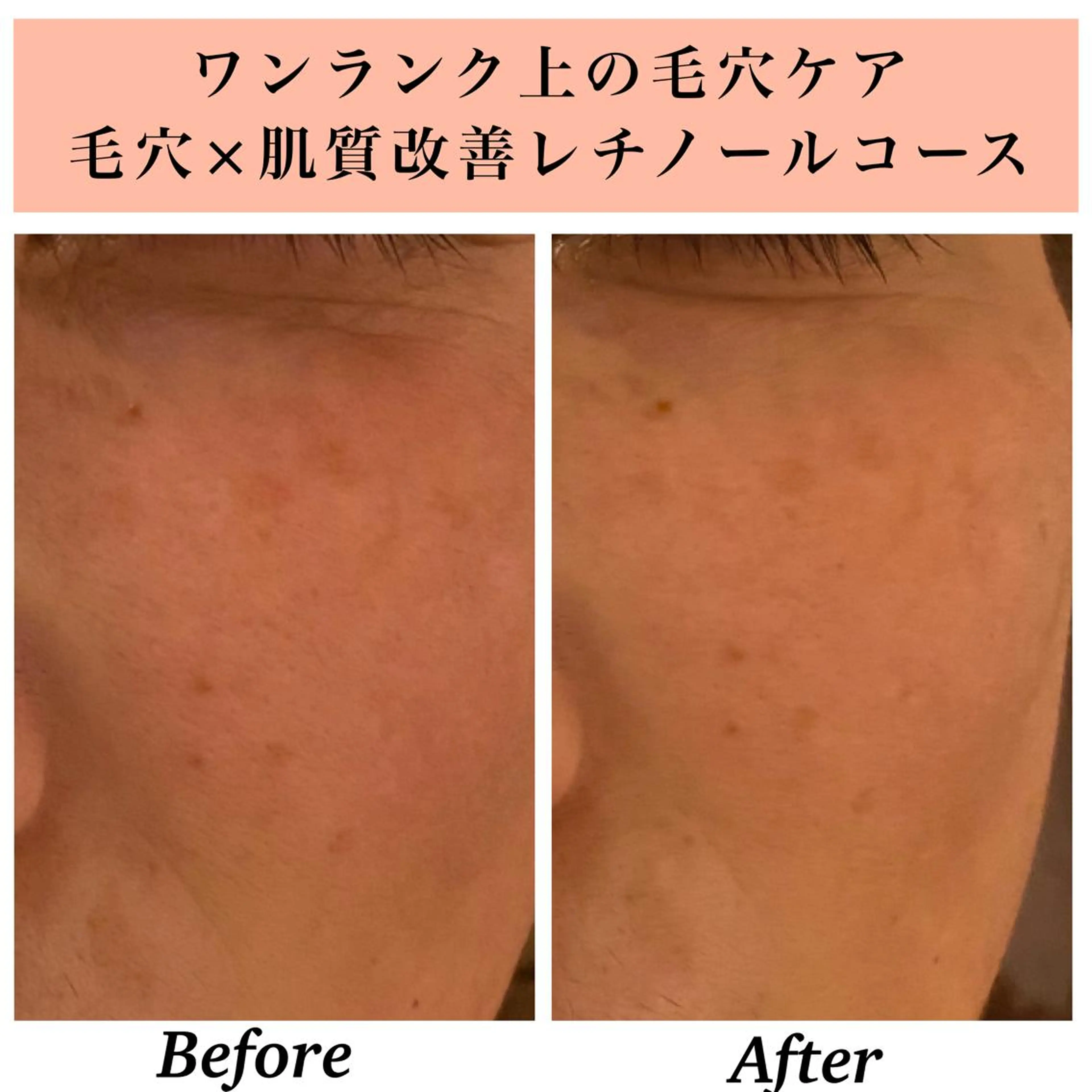 エステ リラク Bellesthe （ベルエステ）のエステ・リラクイメージ