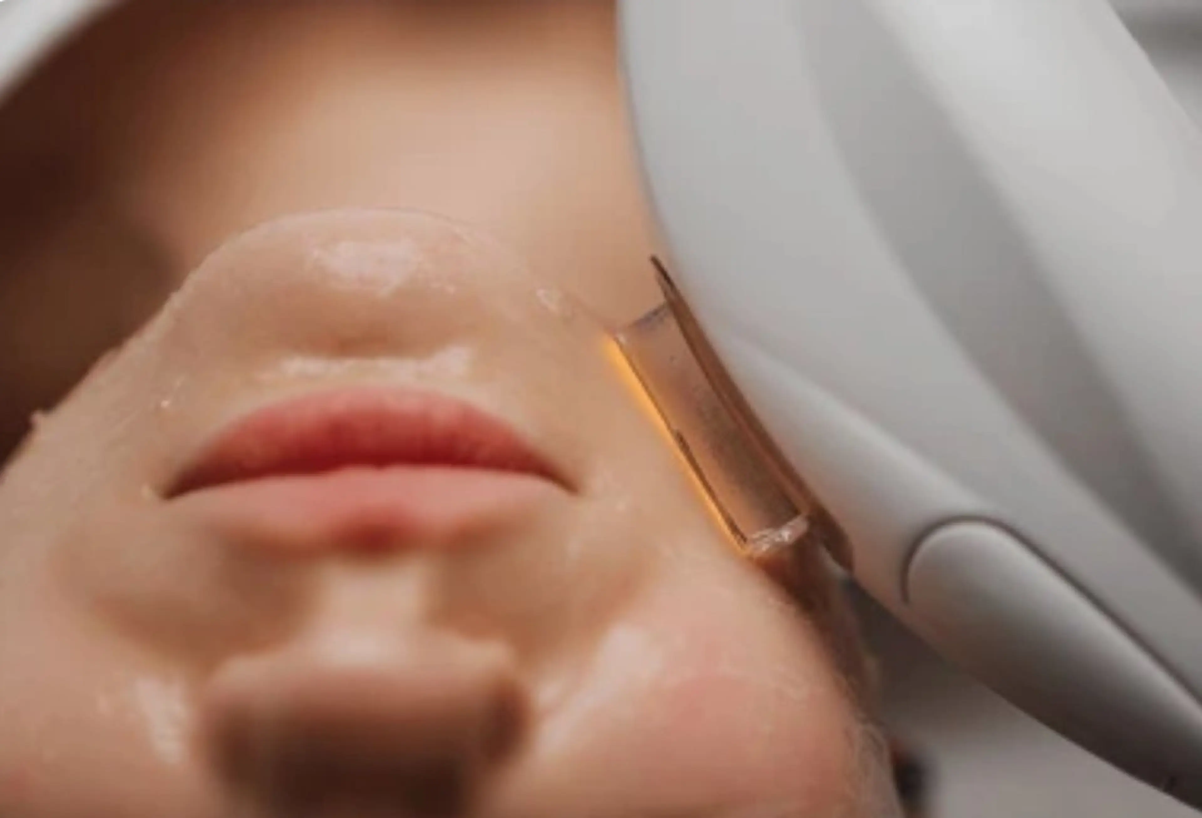 【先行特別価格】あらゆるお肌のお悩みに💆光フェイシャルモニター　￥8,800→￥6,980の写真