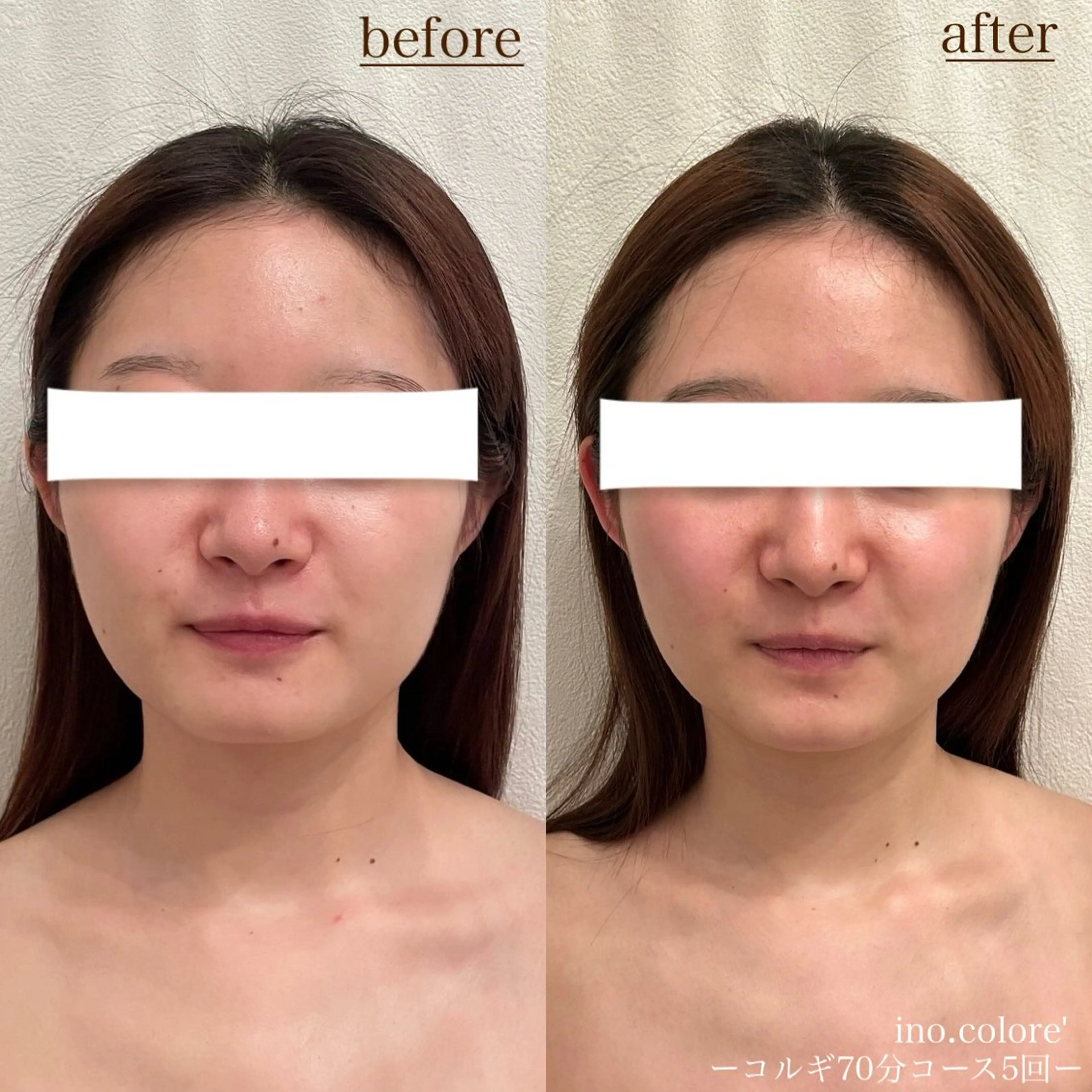 エステサロンino.colore'所属・小顔サロン ino.coloreのエステ・リラクイメージ
