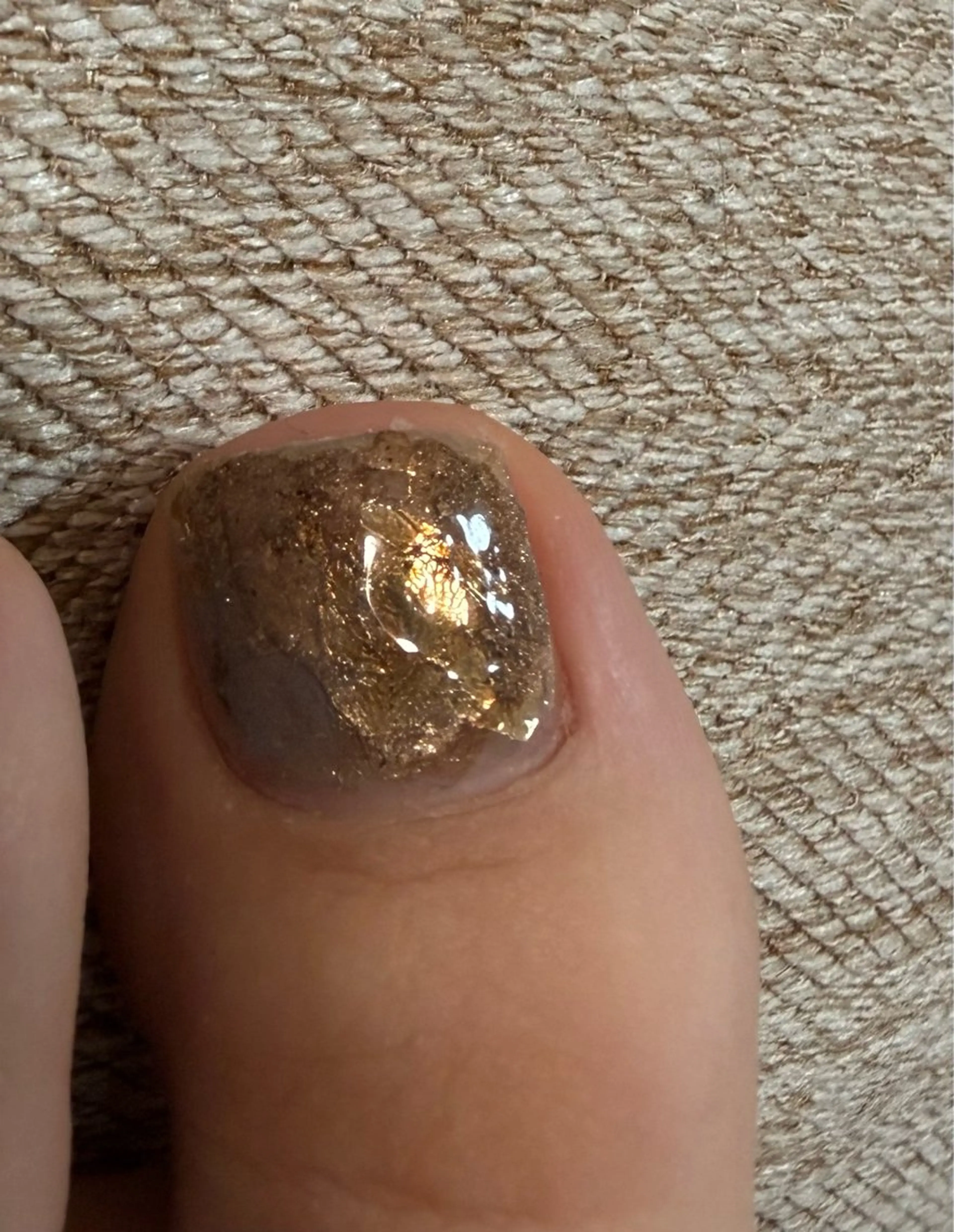 ネイル フットネイル mii 【フィルイン導入】のネイルデザイン