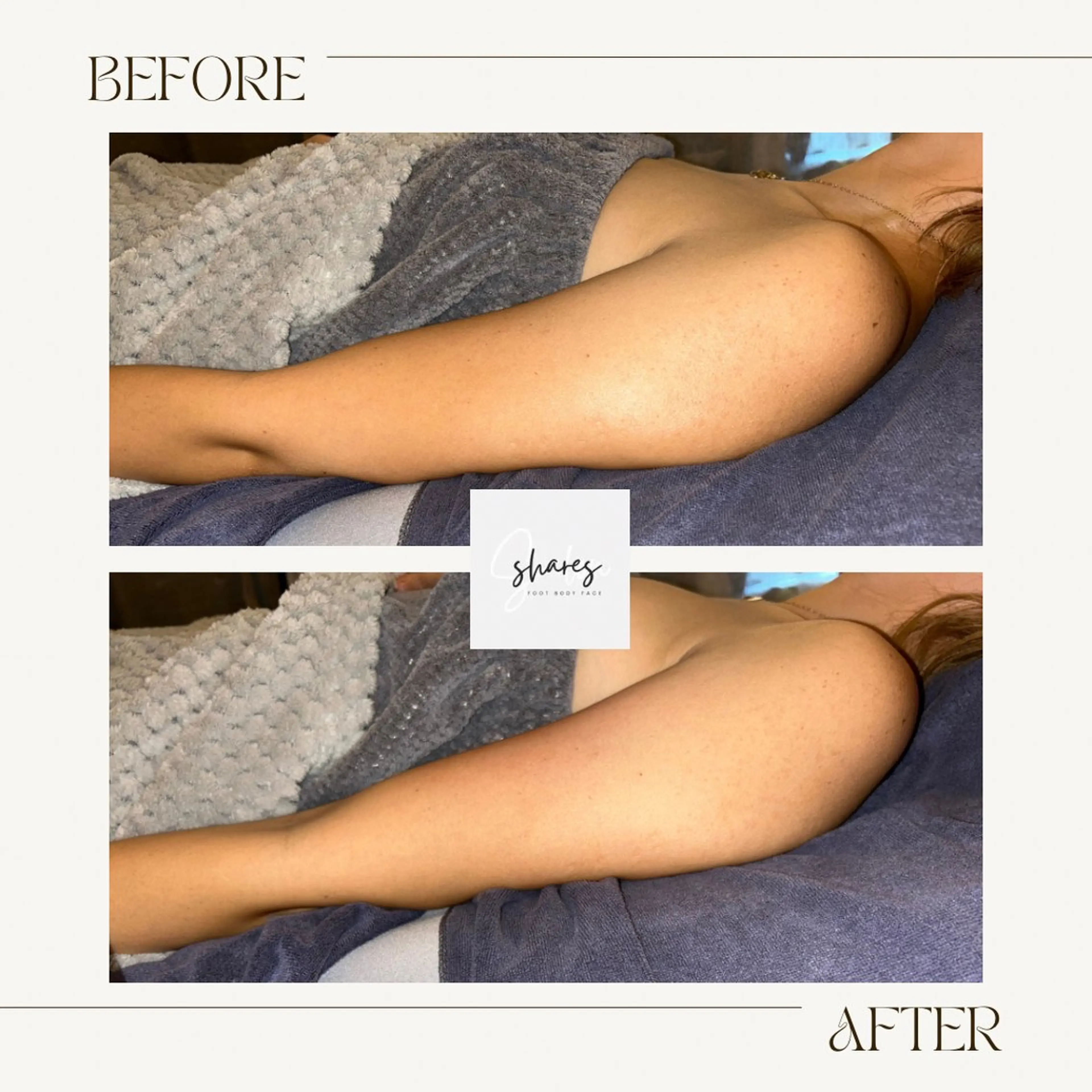 salon shares 辻堂店所属・SHARES AOIのエステ・リラクイメージ