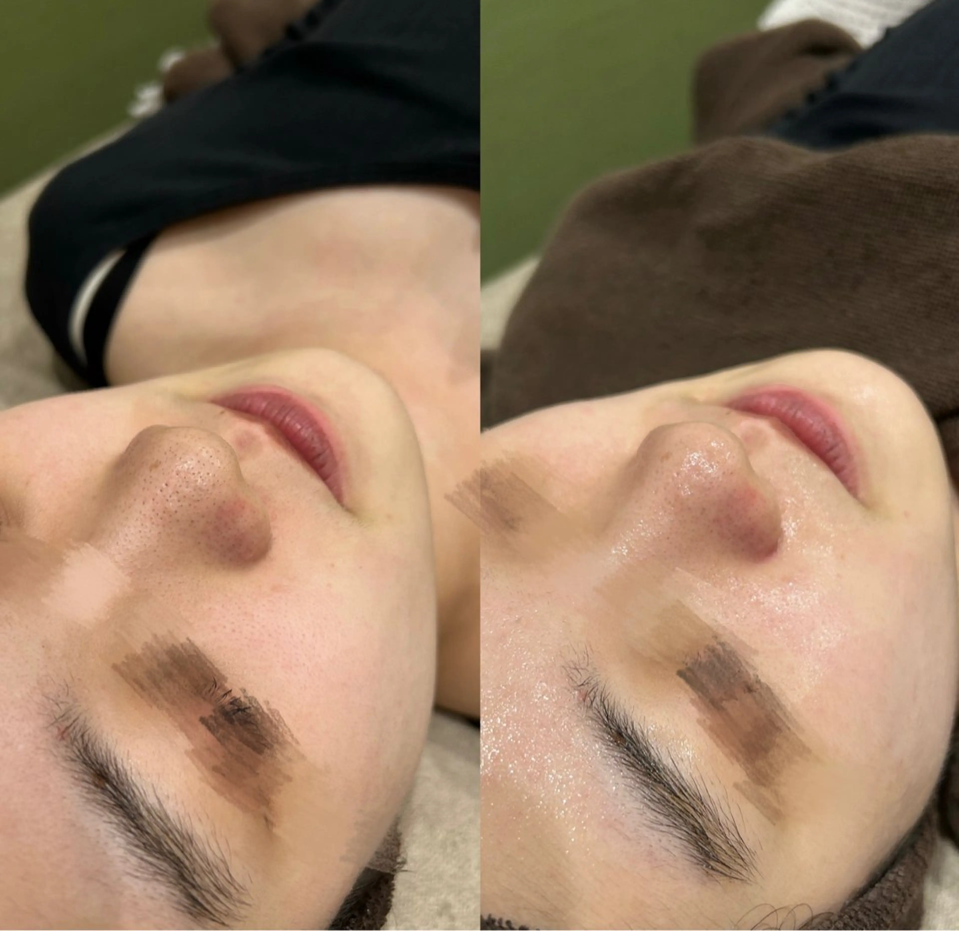 エステ 💎美容革命ラボ💎 大名店のエステ・リラクイメージ