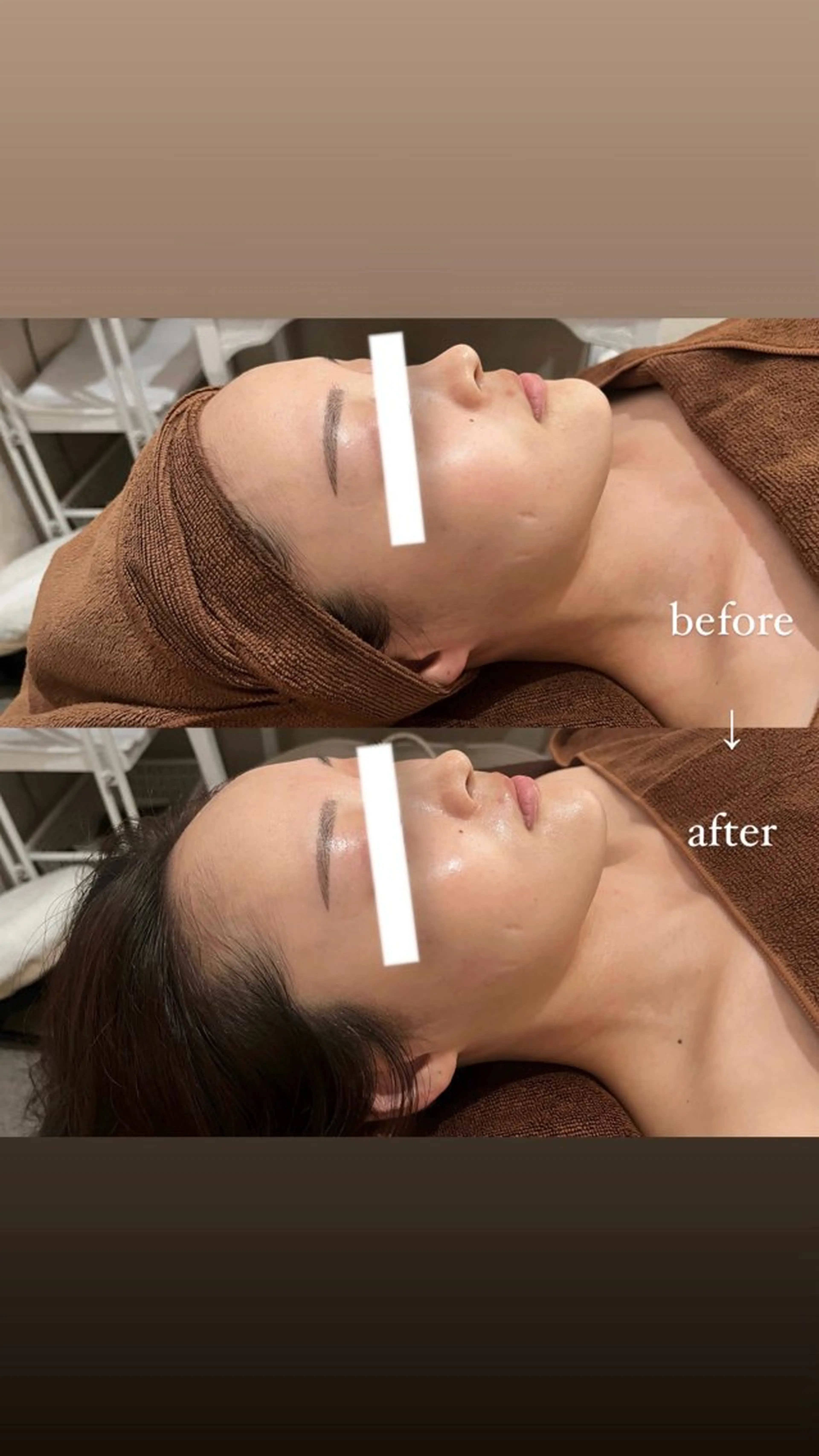 NOEL所属・フェイシャルエステ Utaiのエステ・リラクイメージ