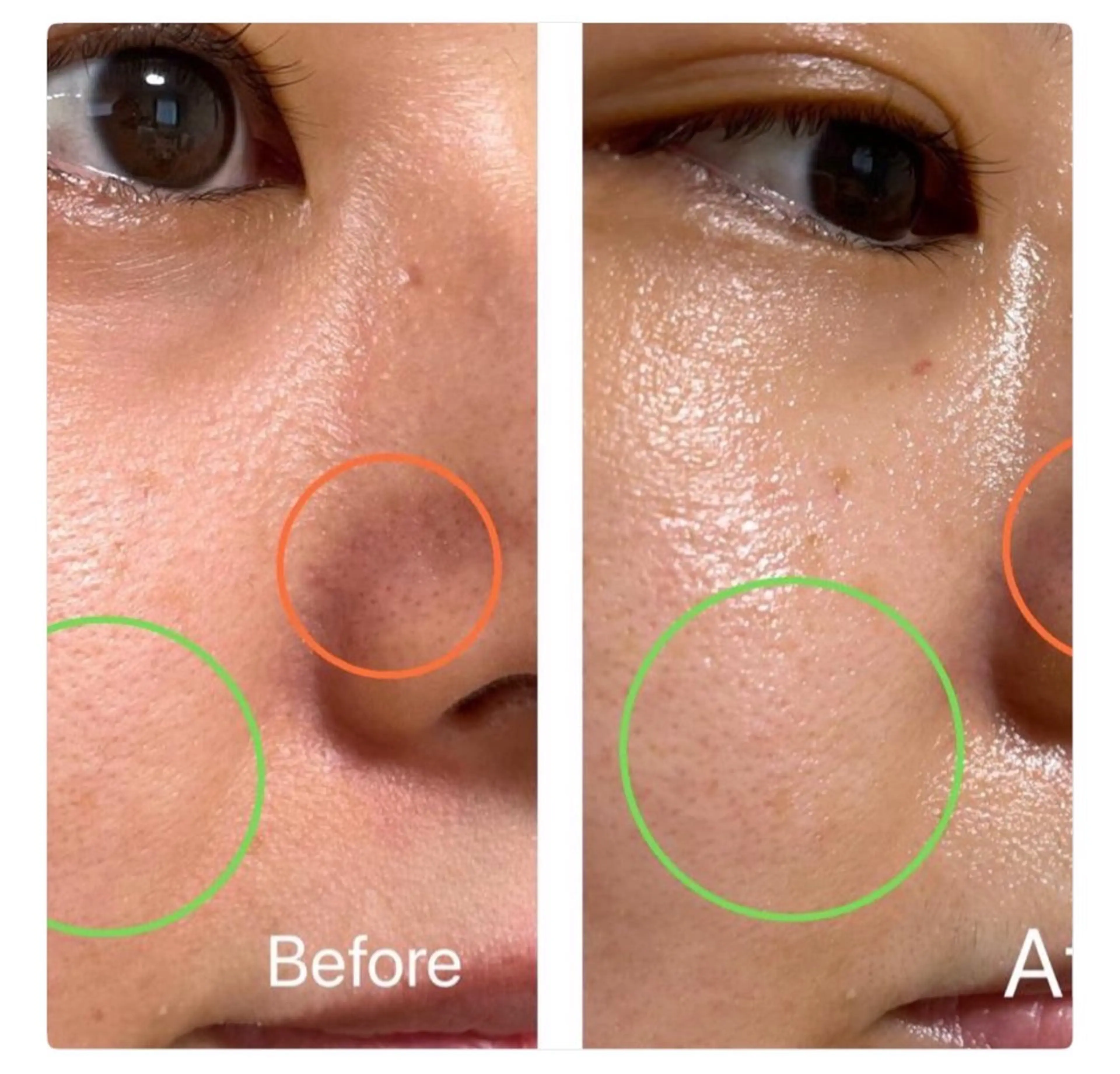 【堺市/泉ヶ丘駅】フェイシャルエステサロンSalon de jewel'm所属・Salon de jewel'm なおのエステ・リラクイメージ